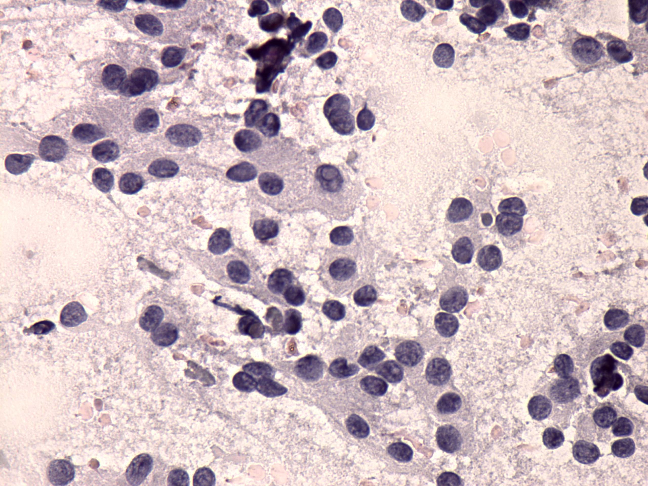 Right lobe, longitudinal scan