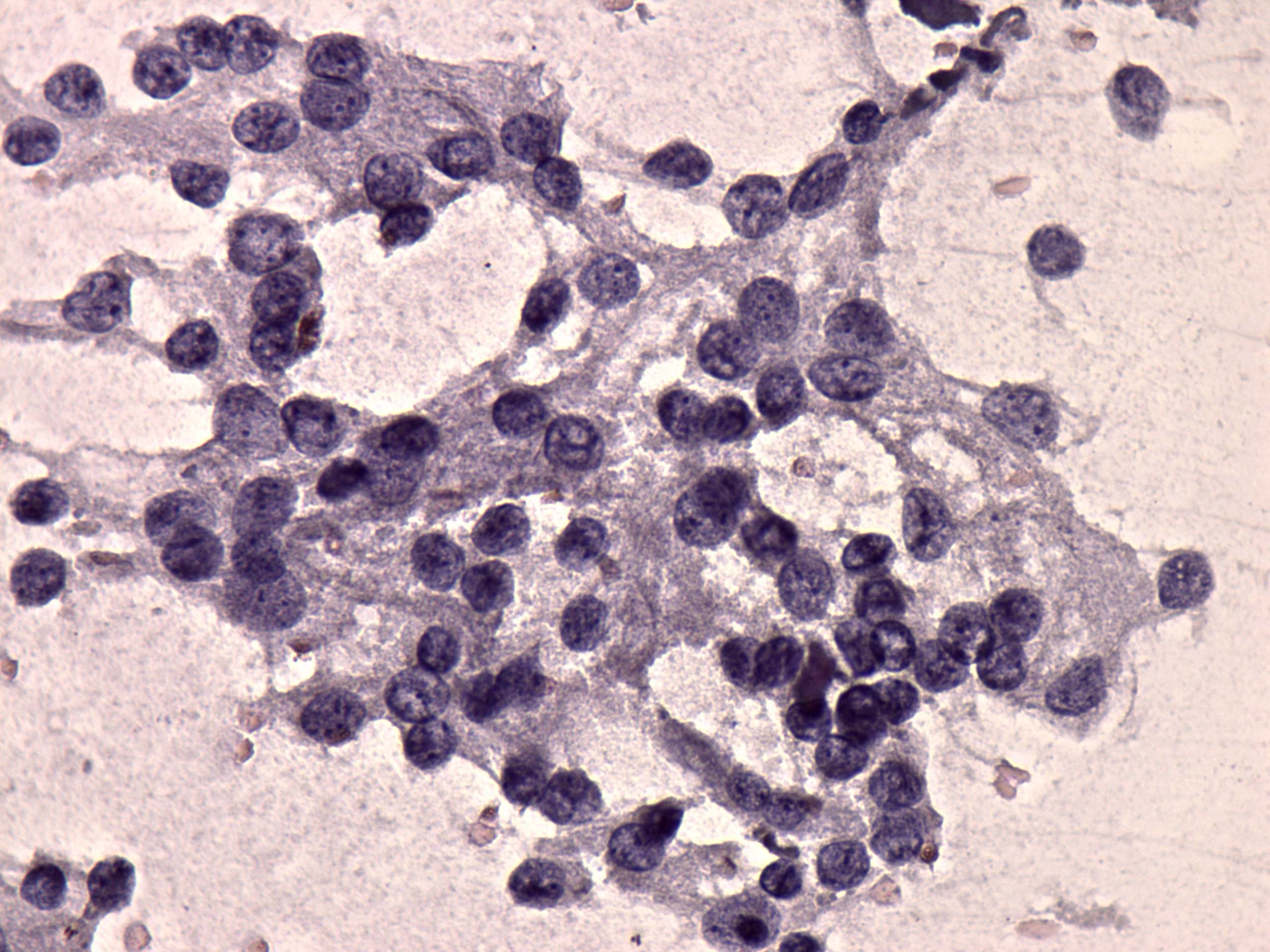 Right lobe, longitudinal scan