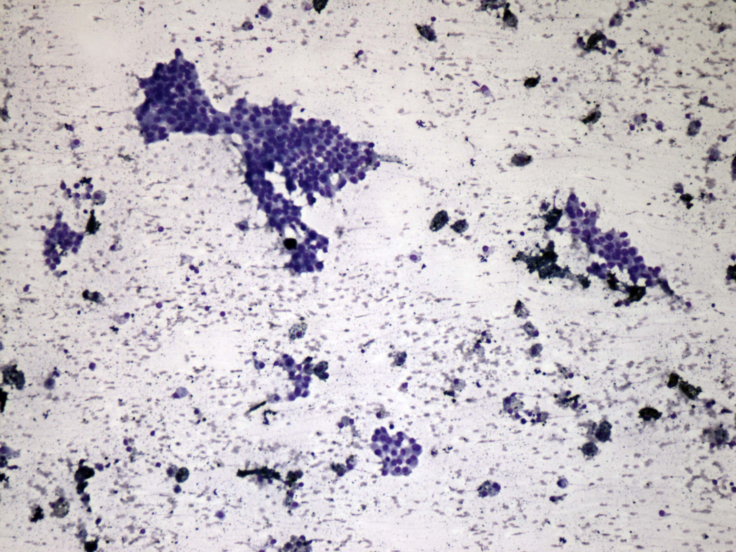 Right lobe, longitudinal scan
