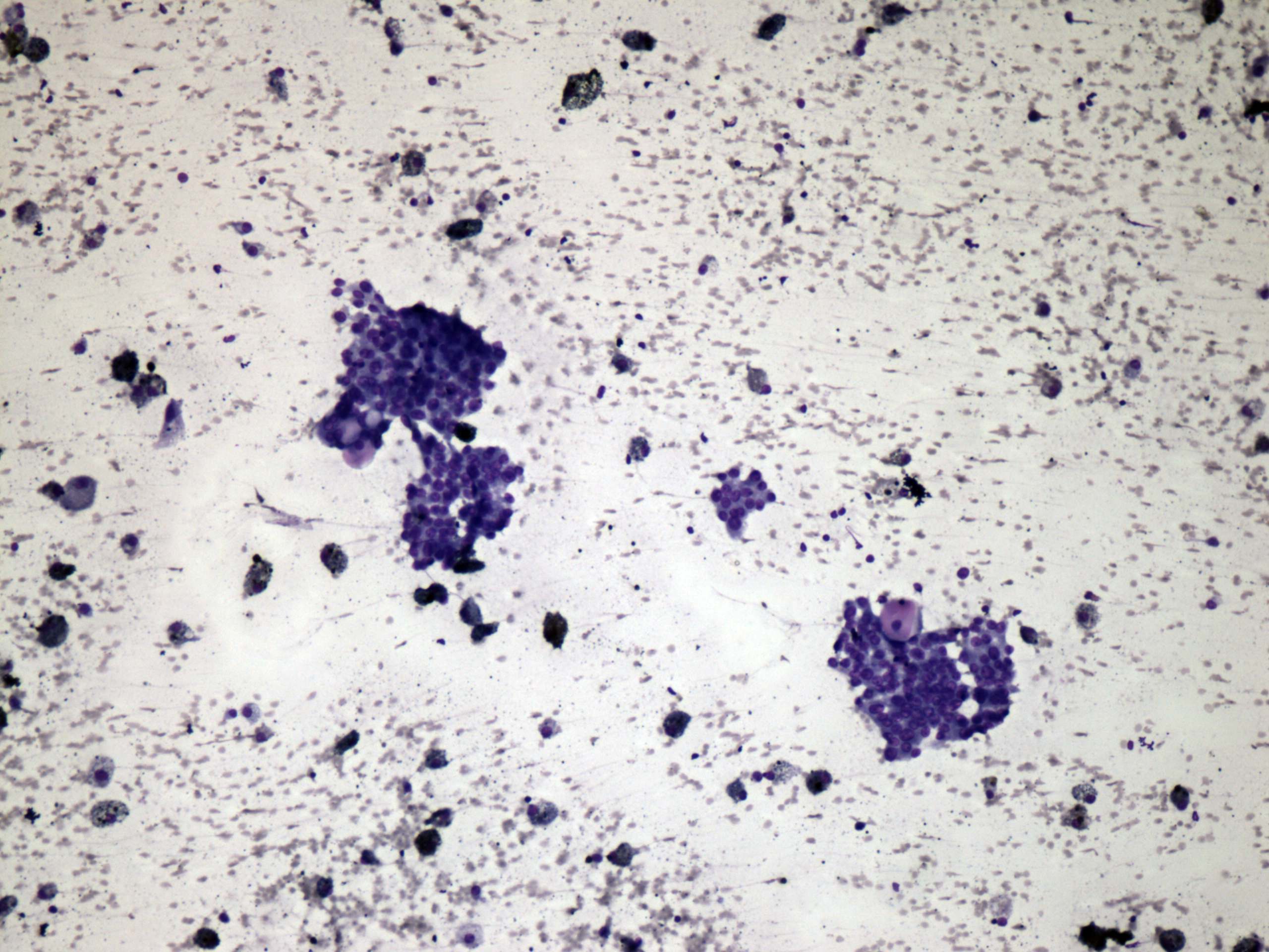 Right lobe, longitudinal scan