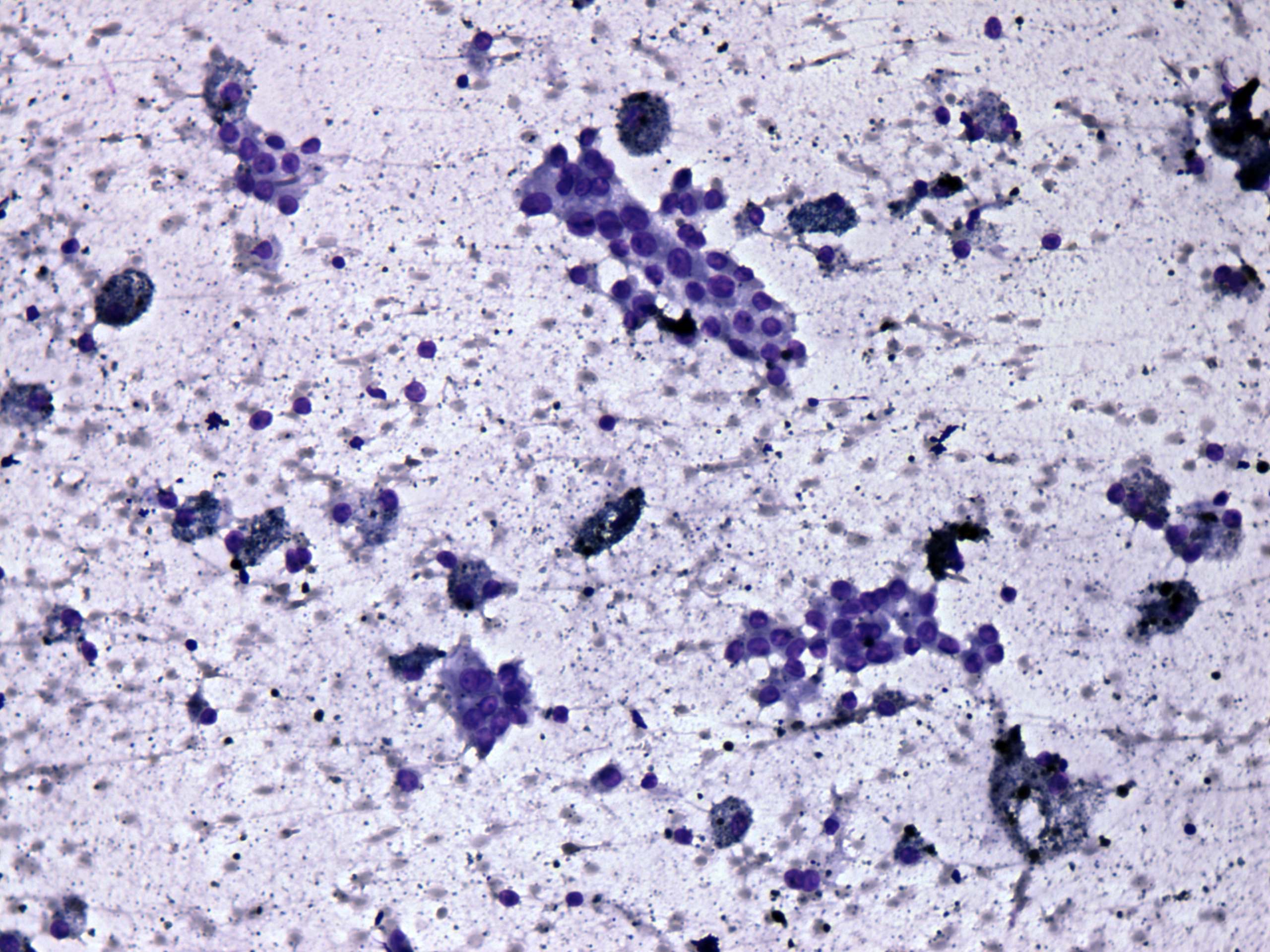 Right lobe, longitudinal scan