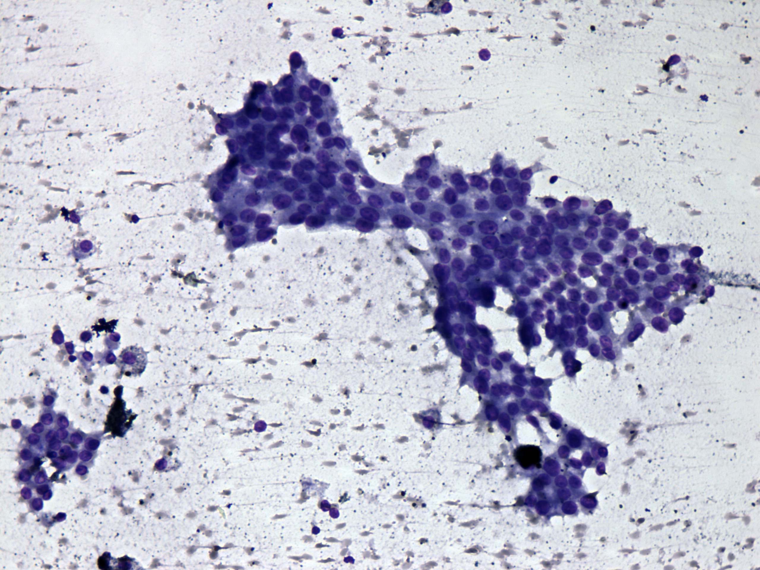 Right lobe, longitudinal scan