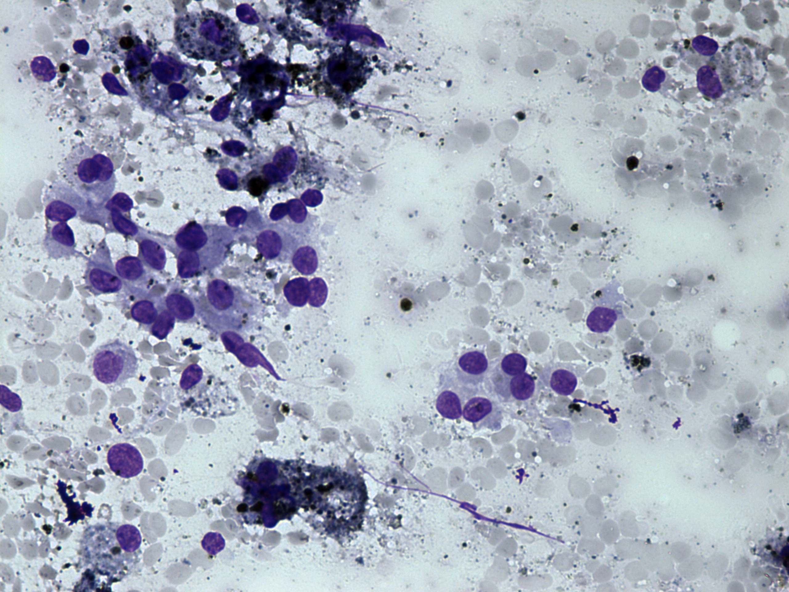 Right lobe, longitudinal scan