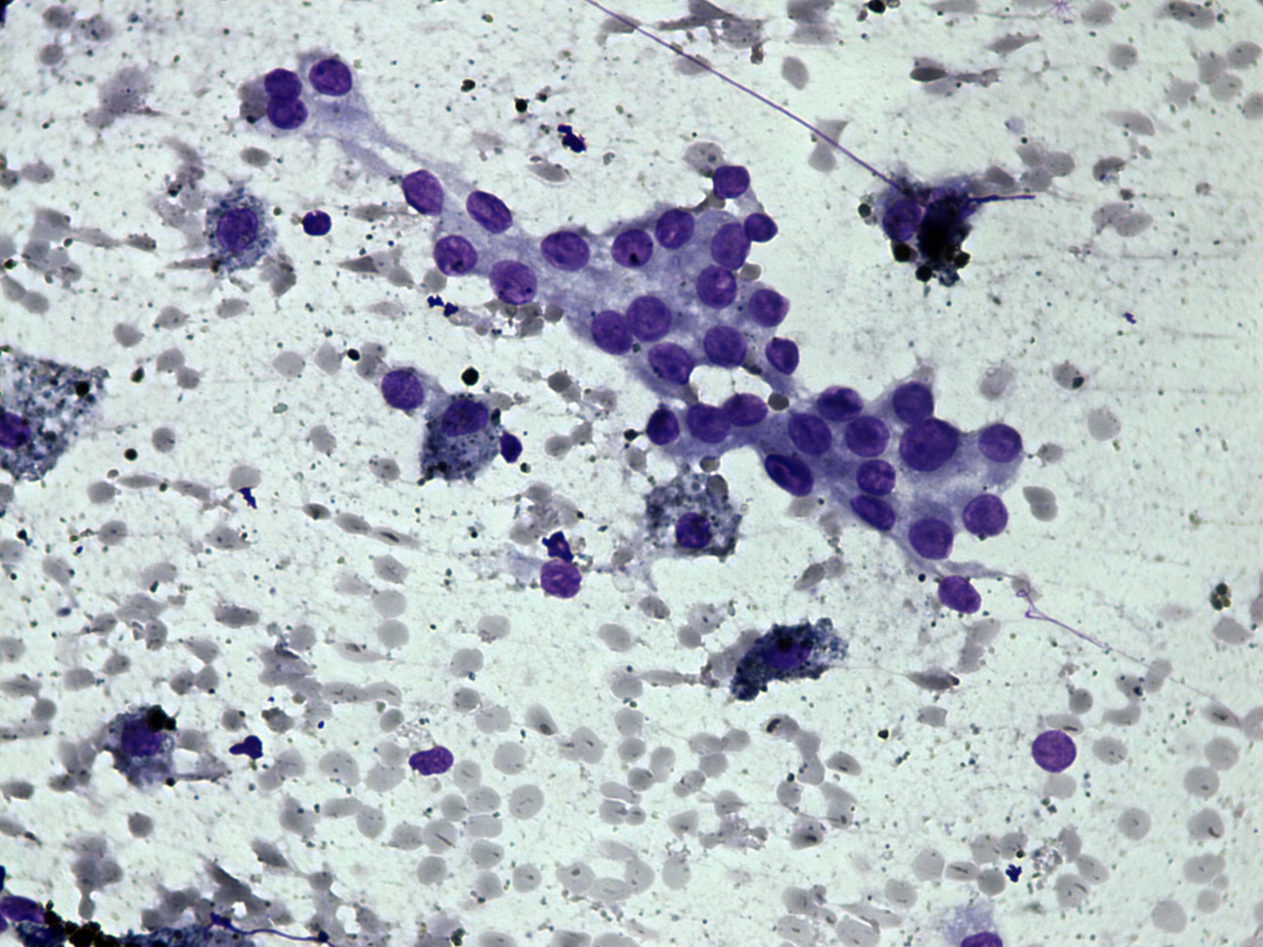Right lobe, longitudinal scan