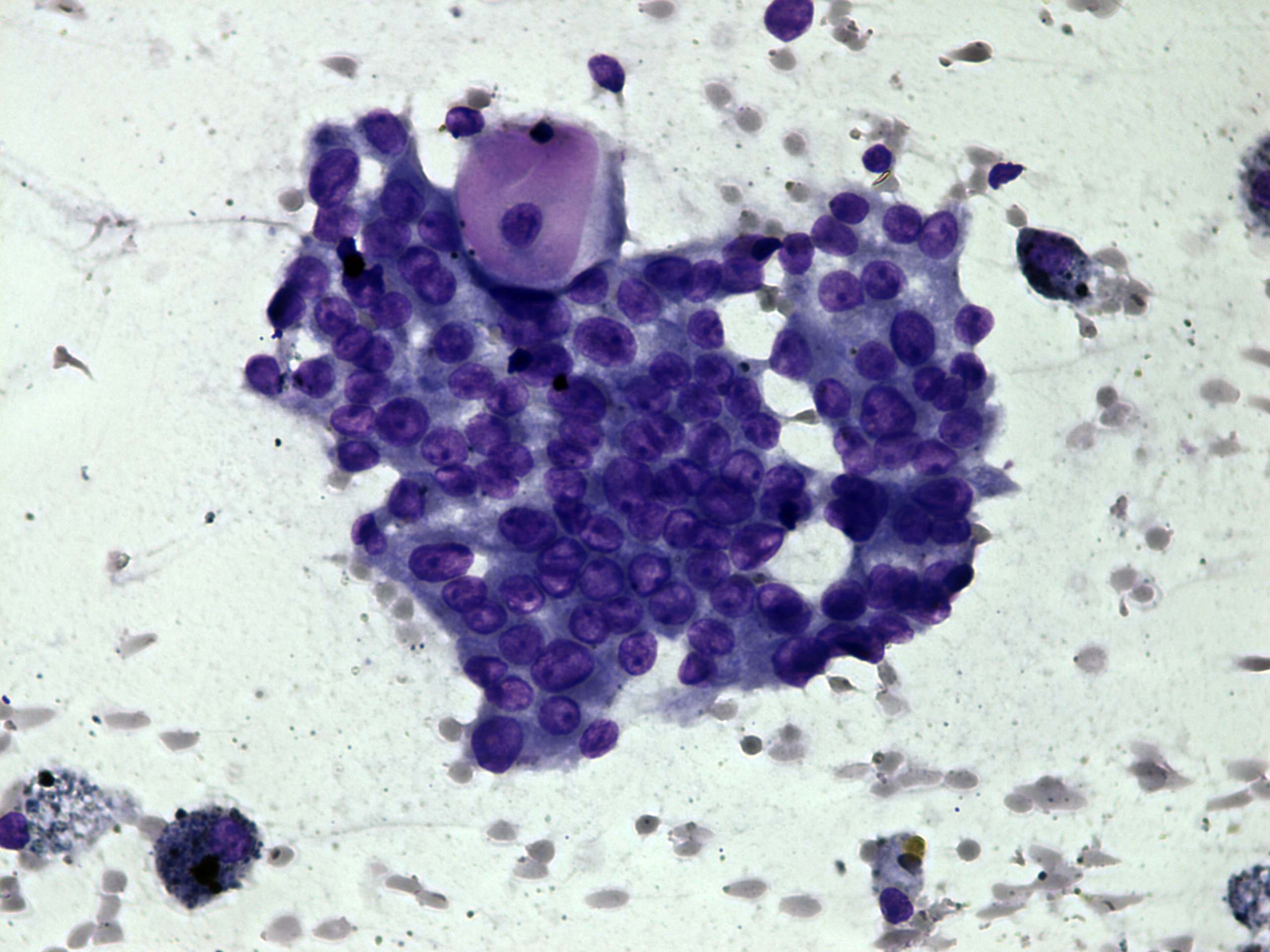 Right lobe, longitudinal scan