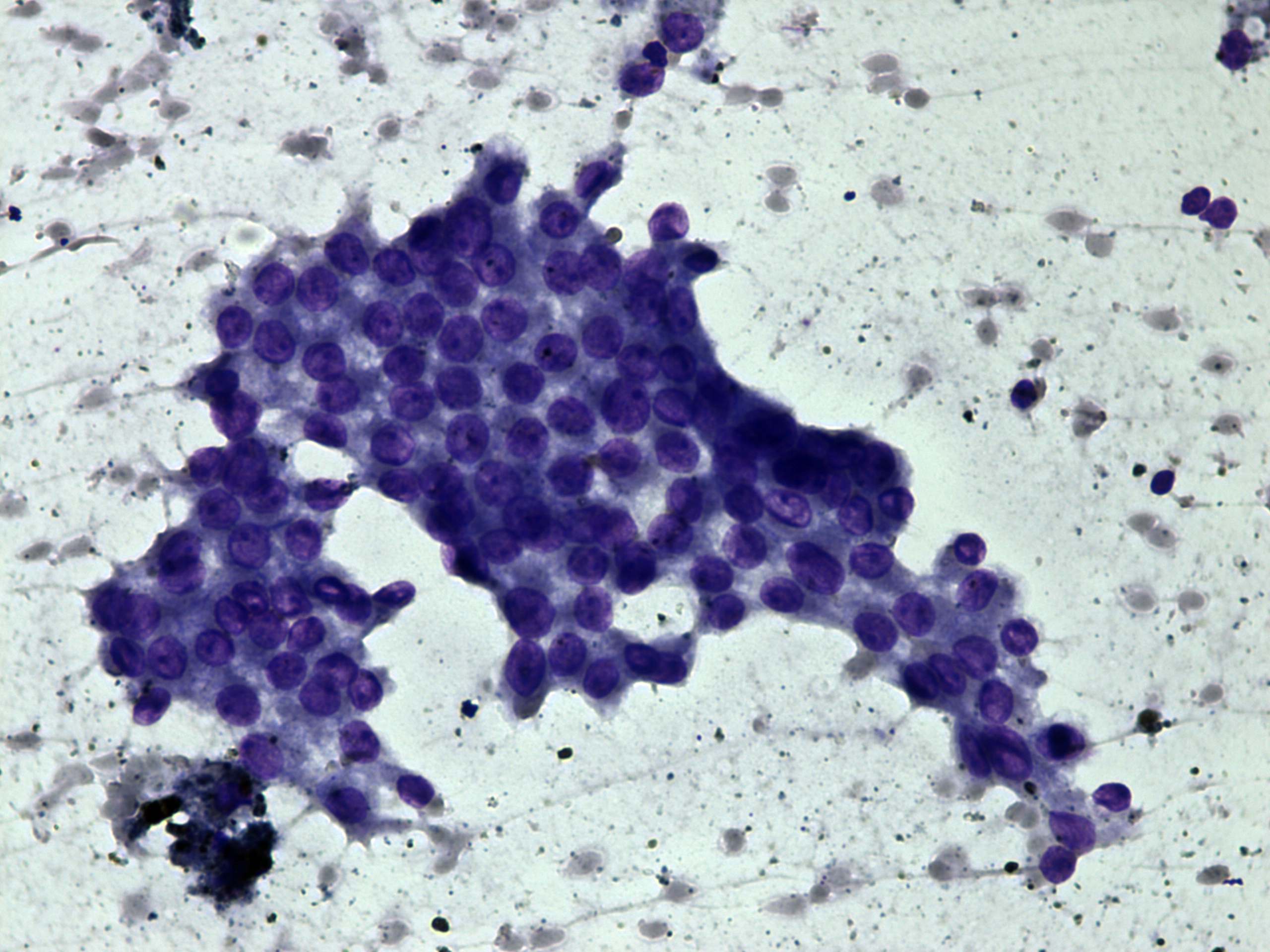 Right lobe, longitudinal scan