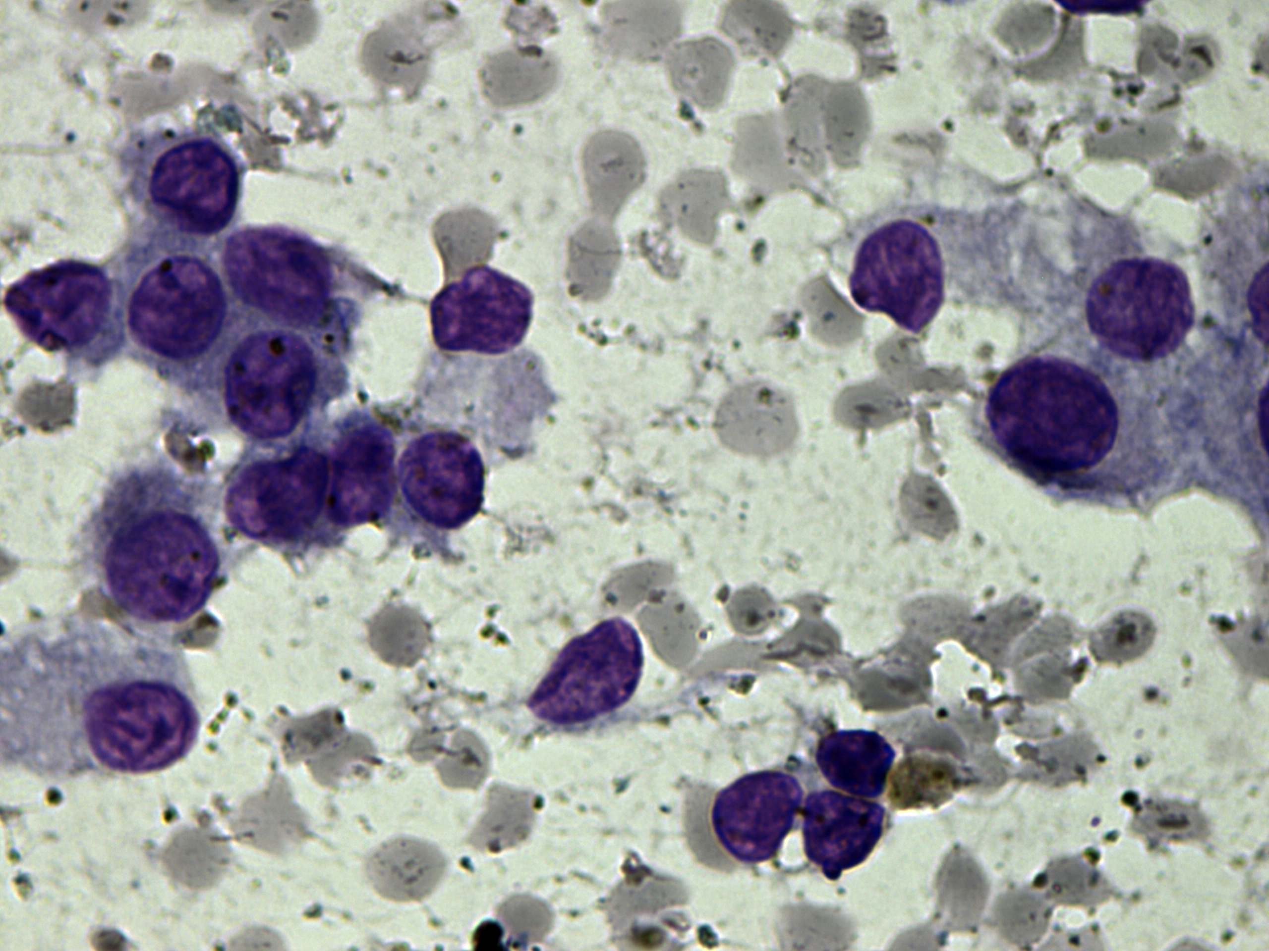 Right lobe, longitudinal scan