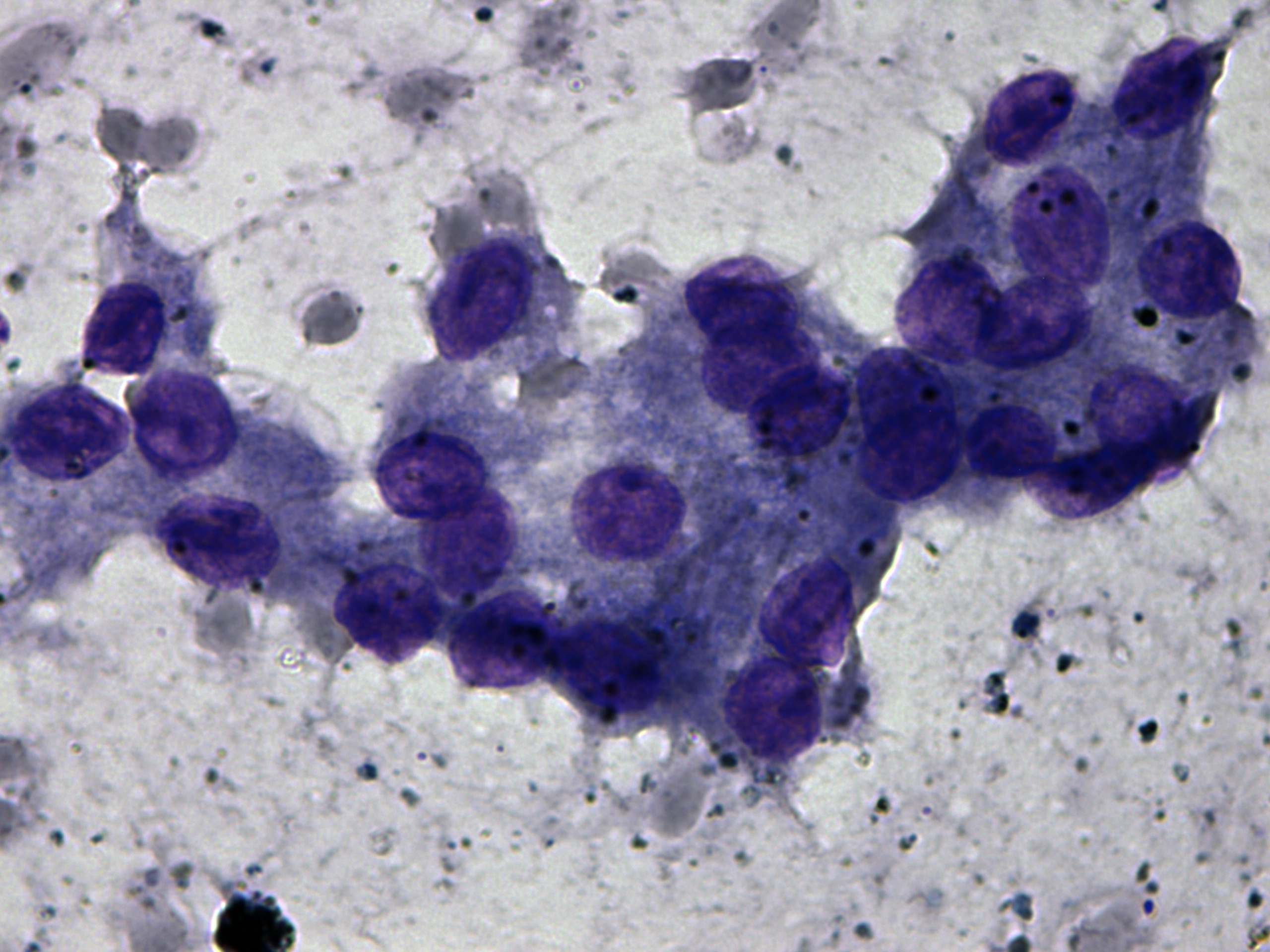 Right lobe, longitudinal scan