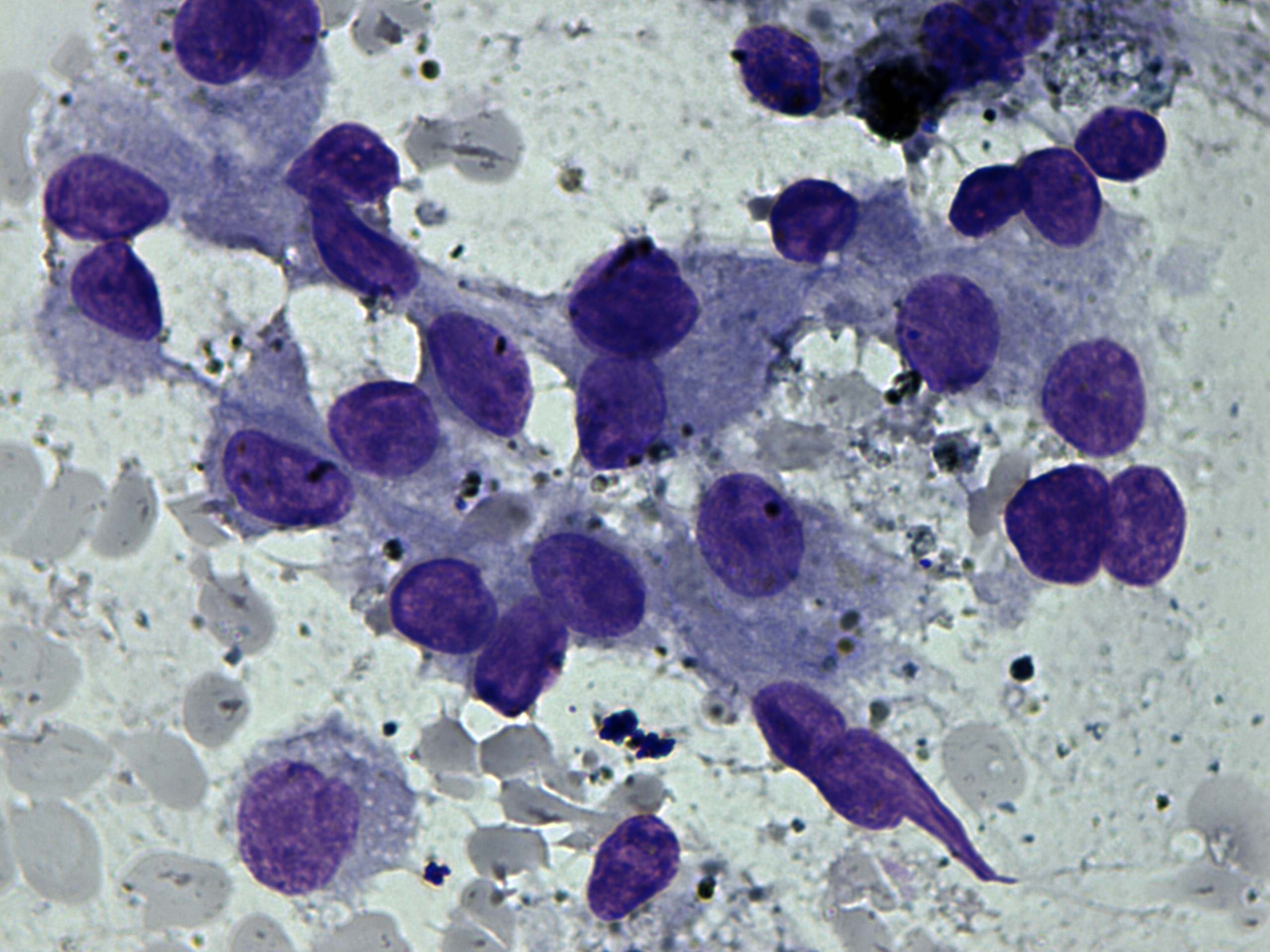 Right lobe, longitudinal scan