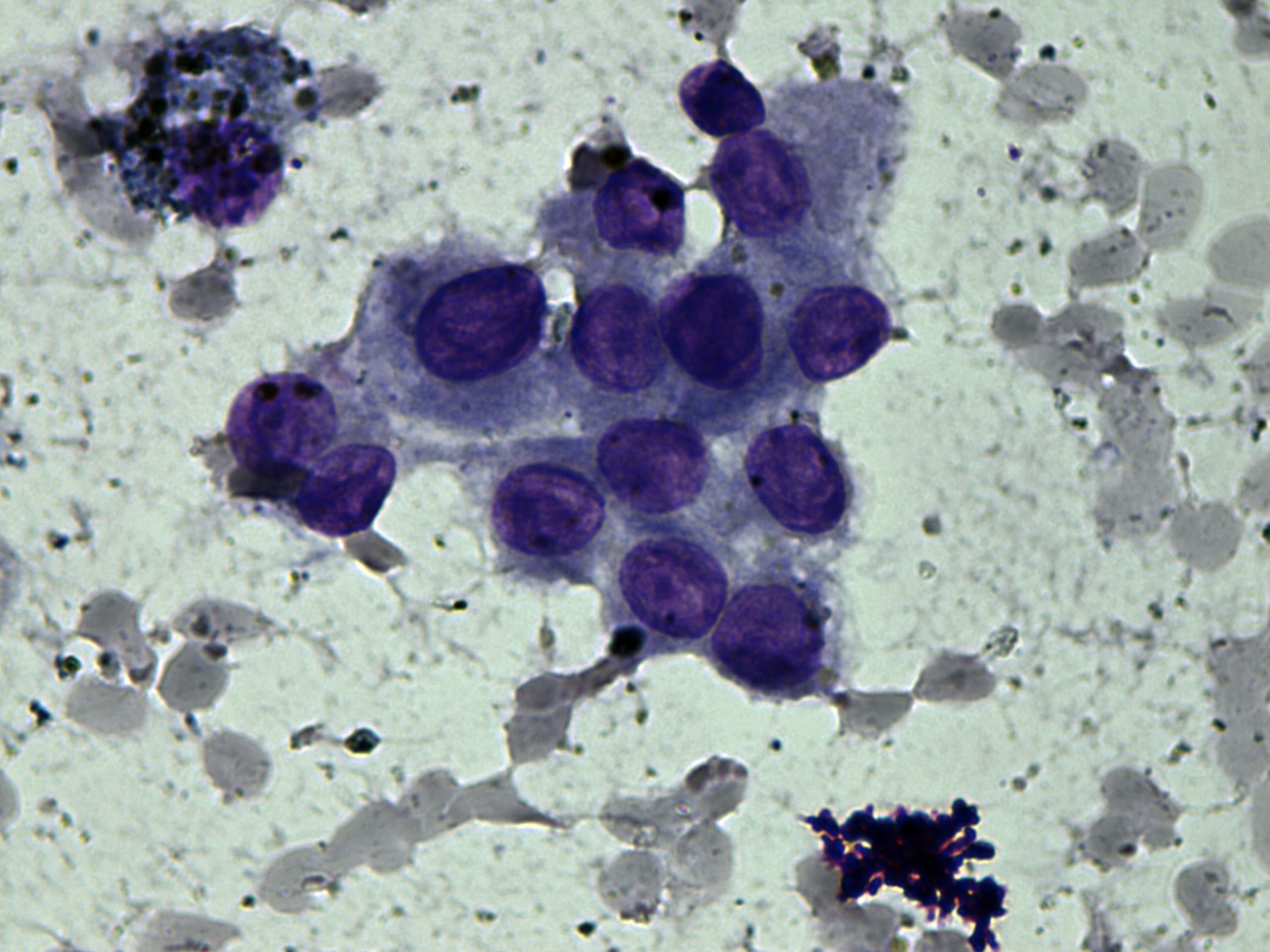 Right lobe, longitudinal scan