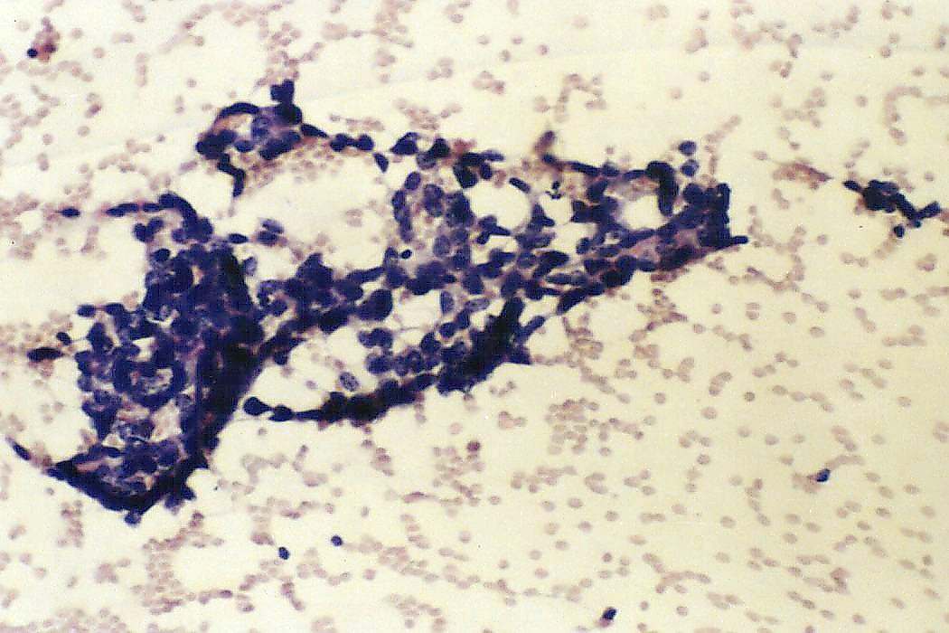 Right lobe, longitudinal scan