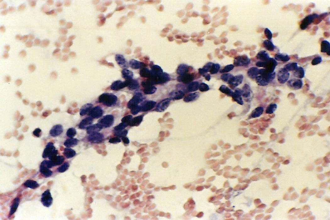 Right lobe, longitudinal scan