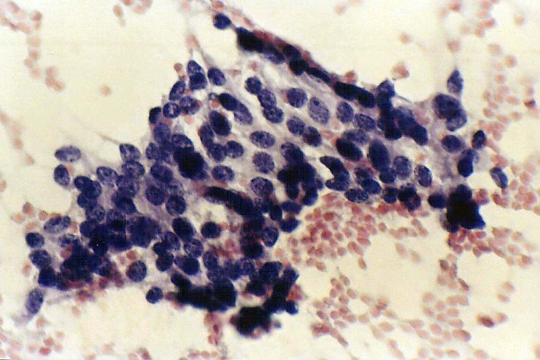 Right lobe, longitudinal scan