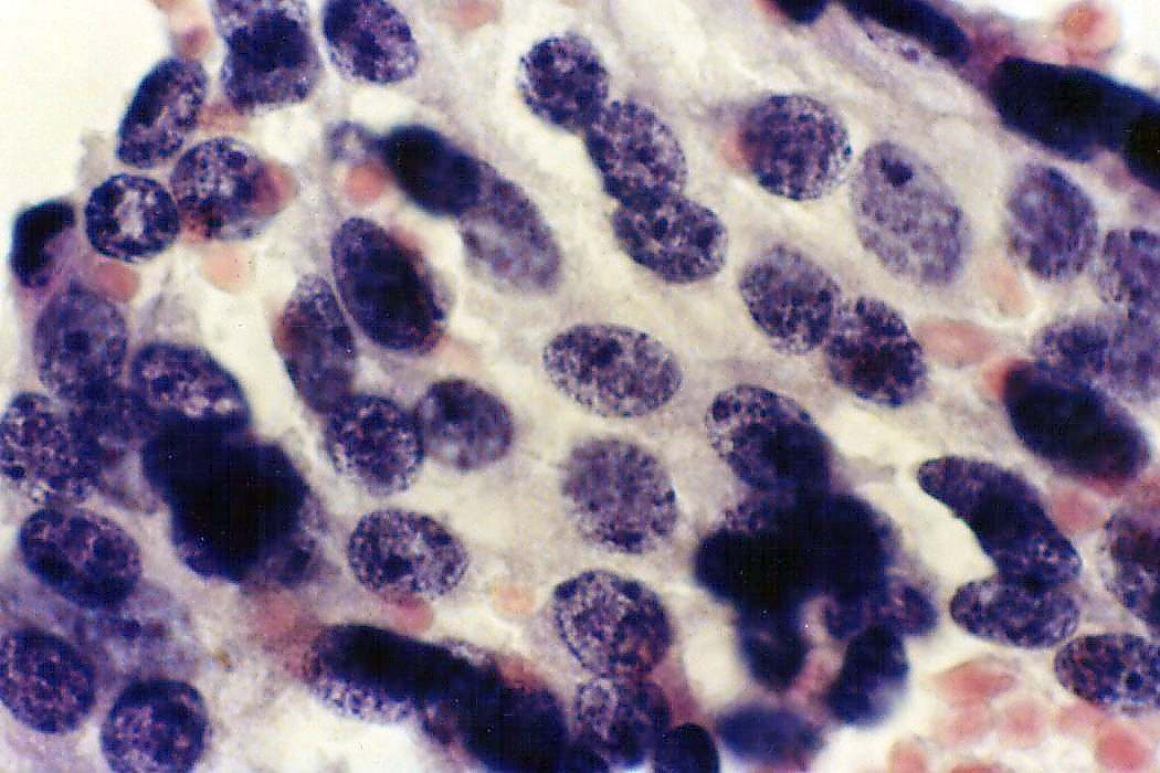 Right lobe, longitudinal scan