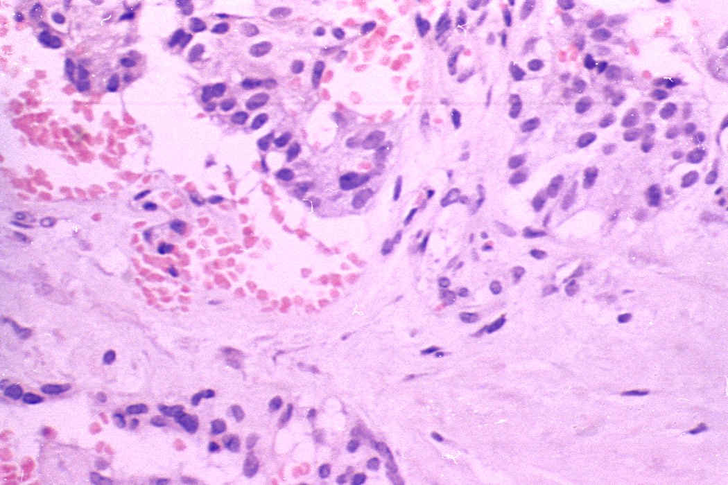 Right lobe, longitudinal scan