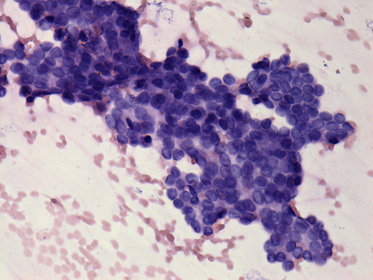 Right lobe, longitudinal scan