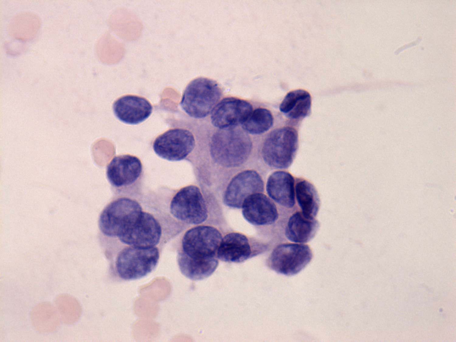 Right lobe, longitudinal scan