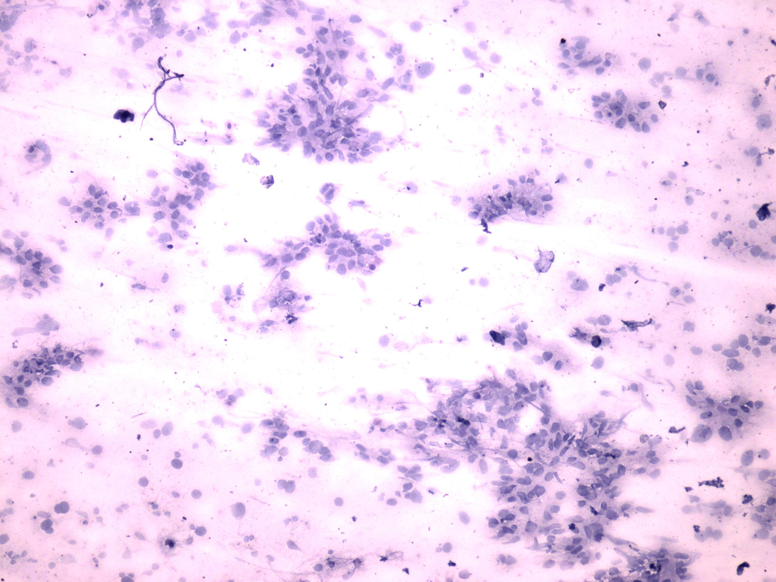 Right lobe, longitudinal scan