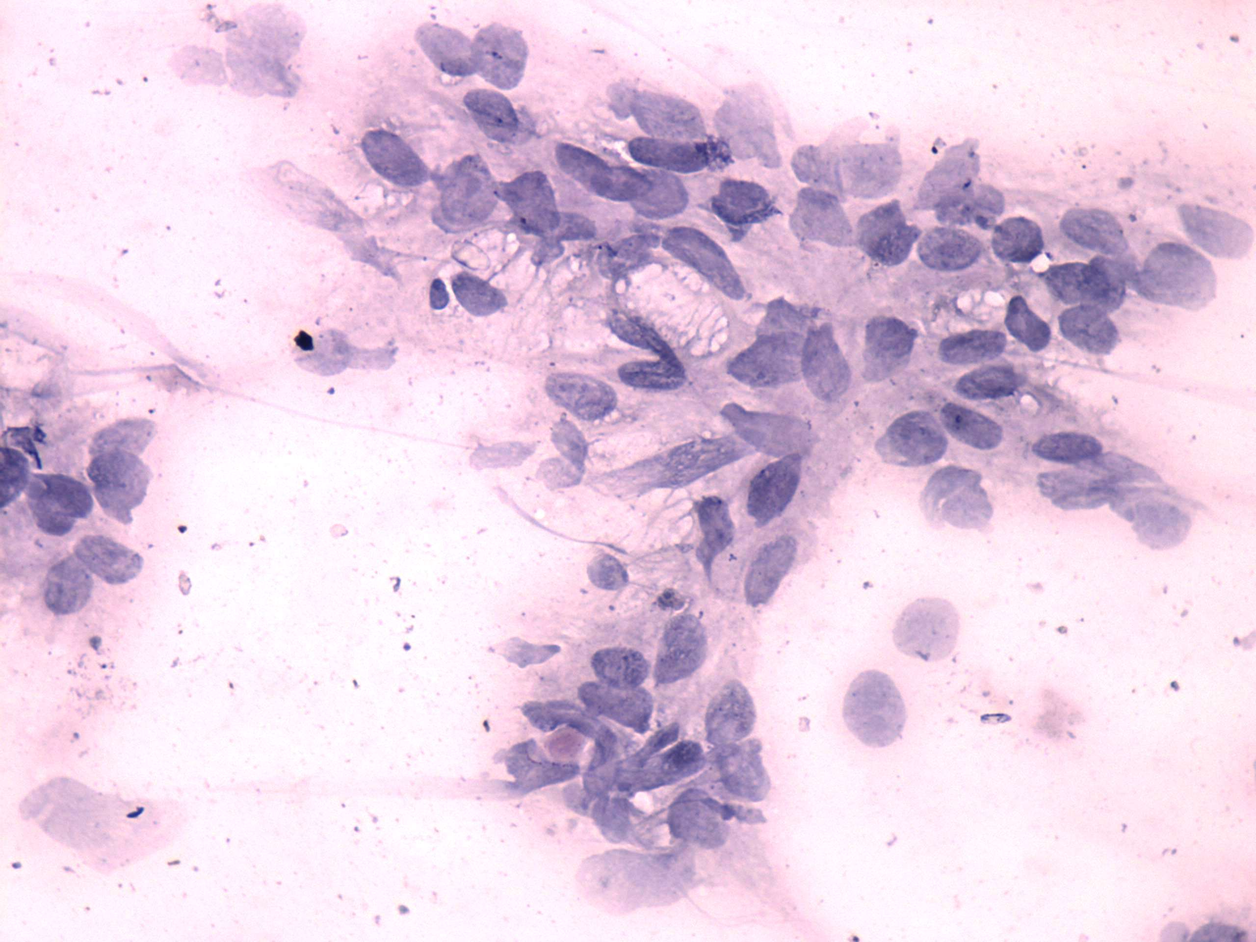 Right lobe, longitudinal scan