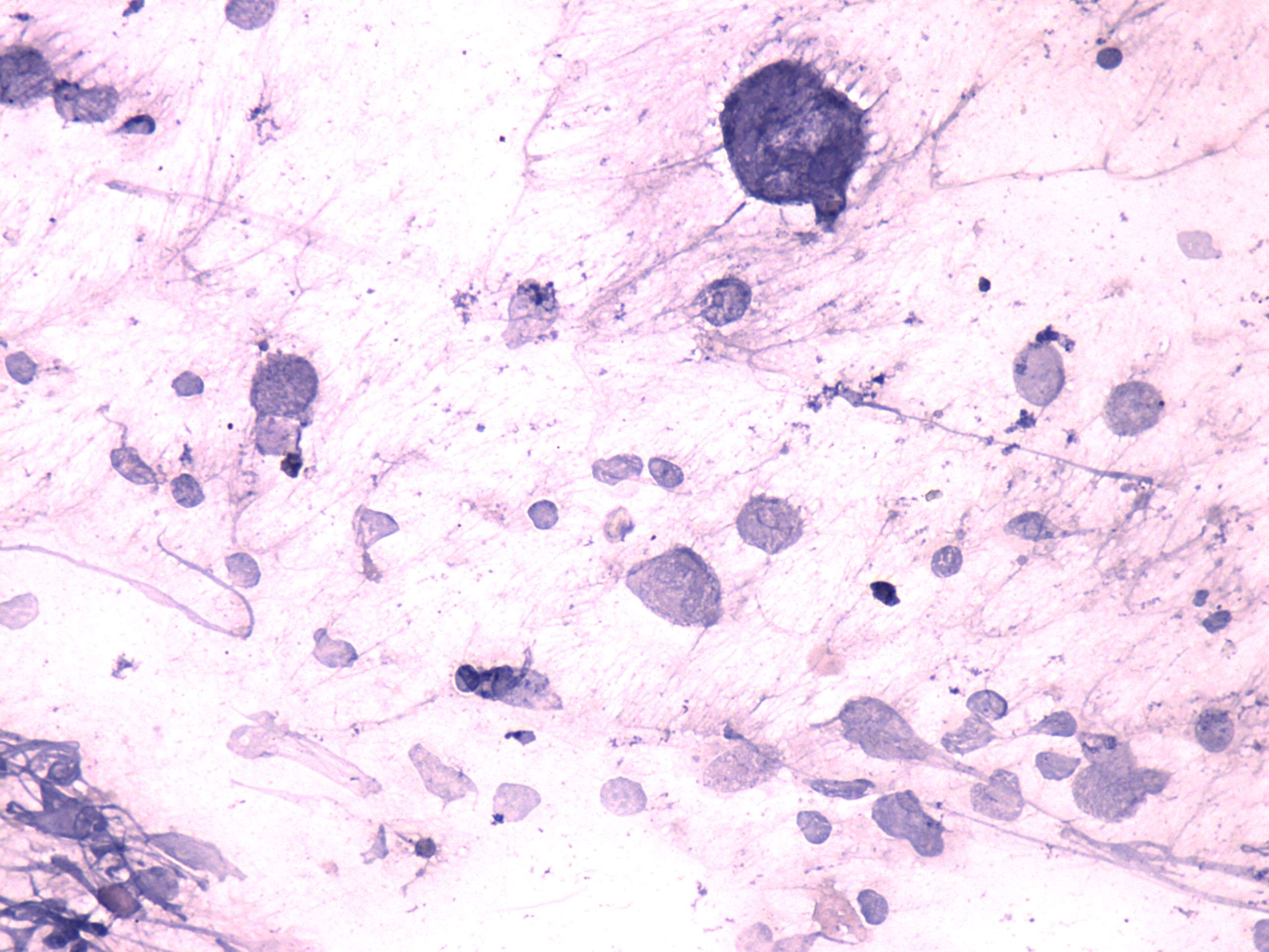 Right lobe, longitudinal scan