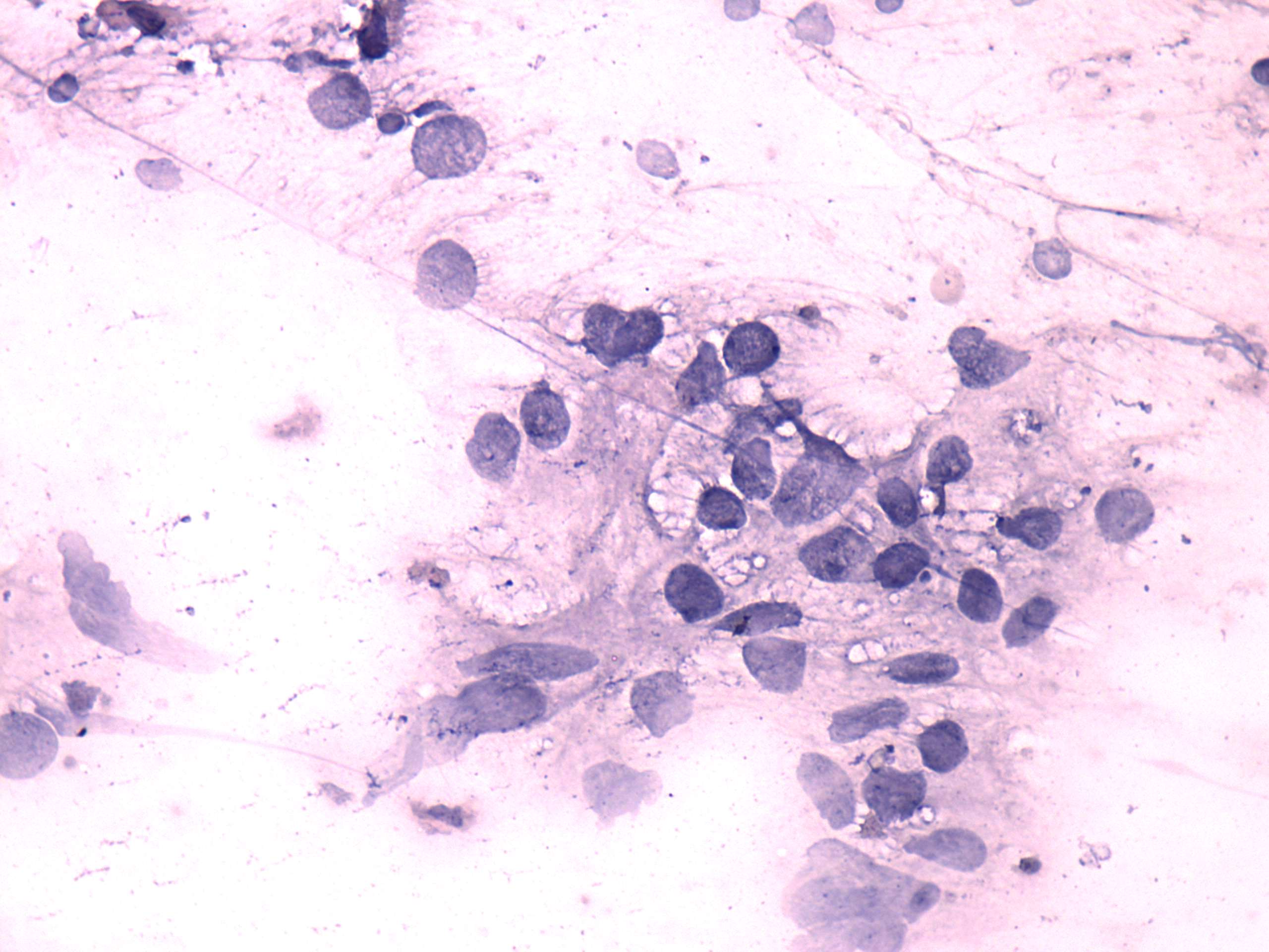 Right lobe, longitudinal scan