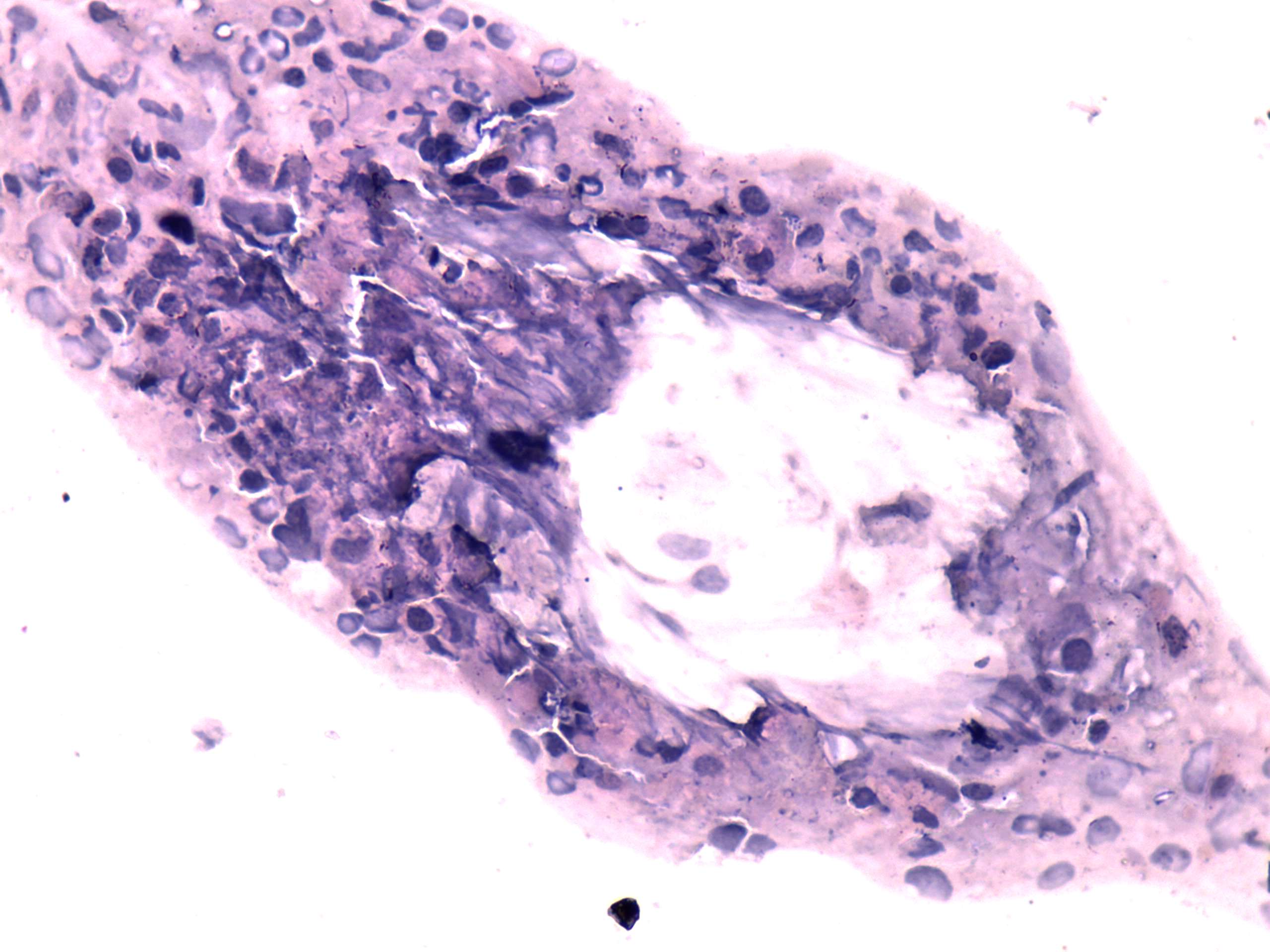Right lobe, longitudinal scan