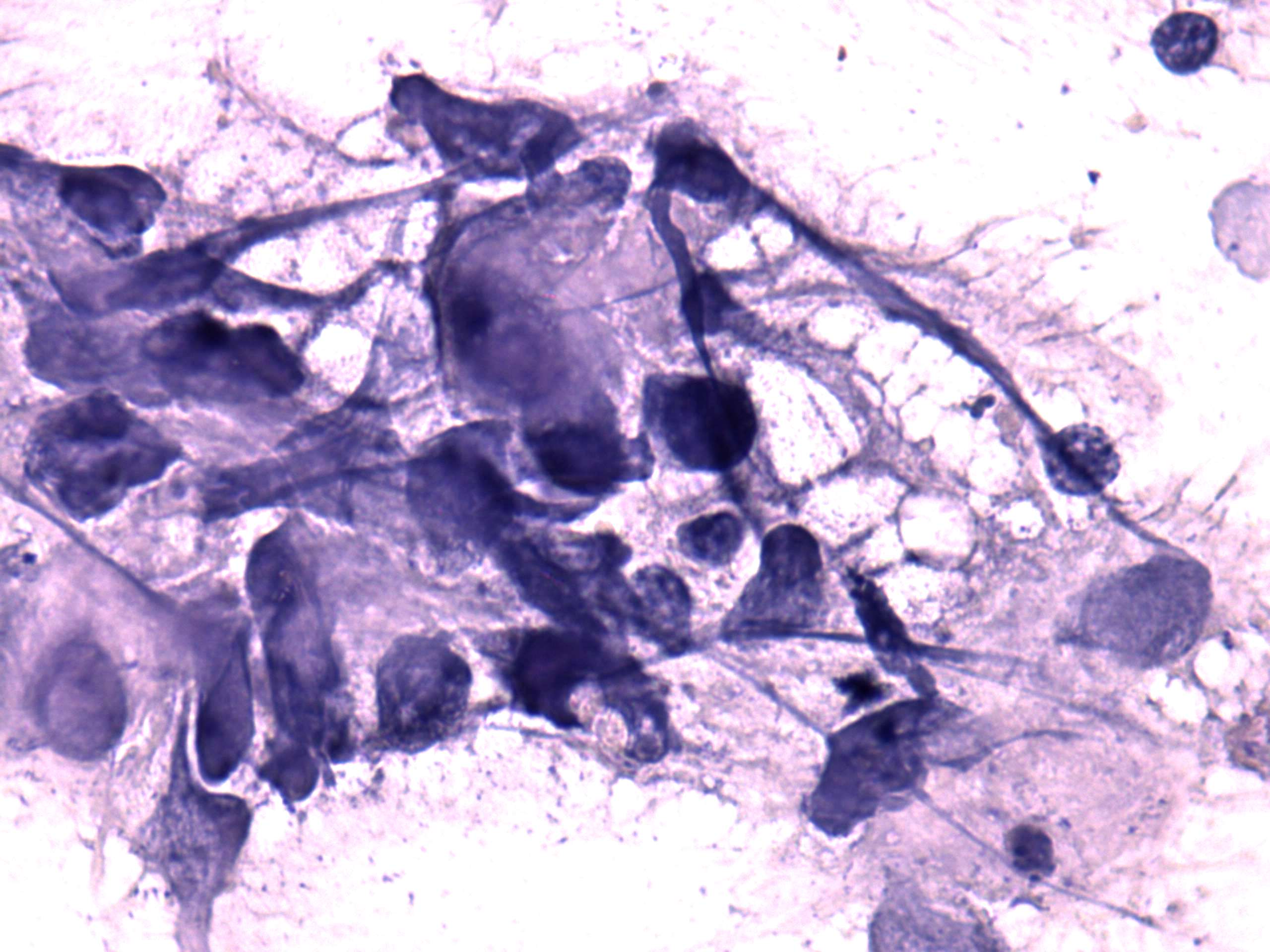 Right lobe, longitudinal scan