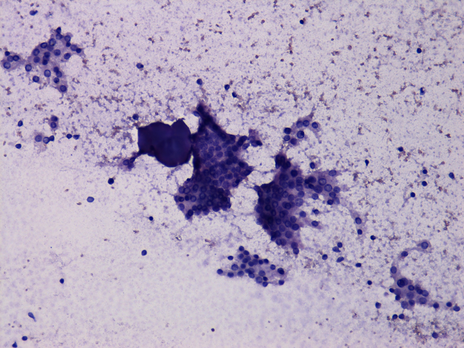 Right lobe, longitudinal scan