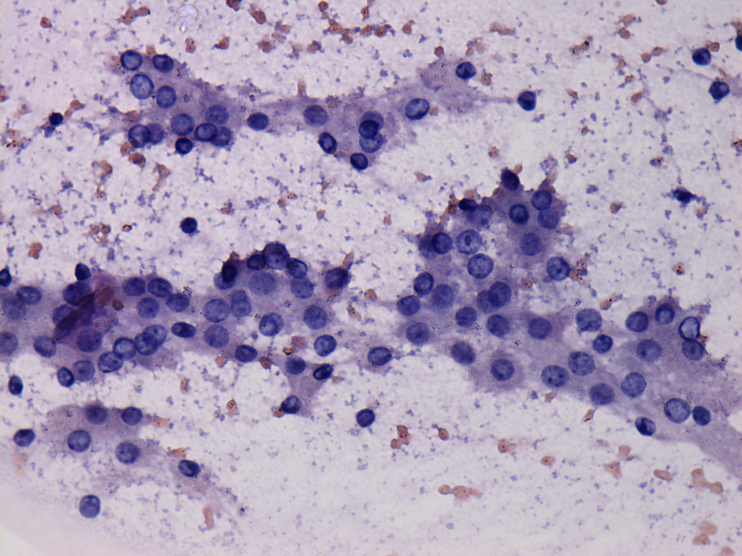 Right lobe, longitudinal scan