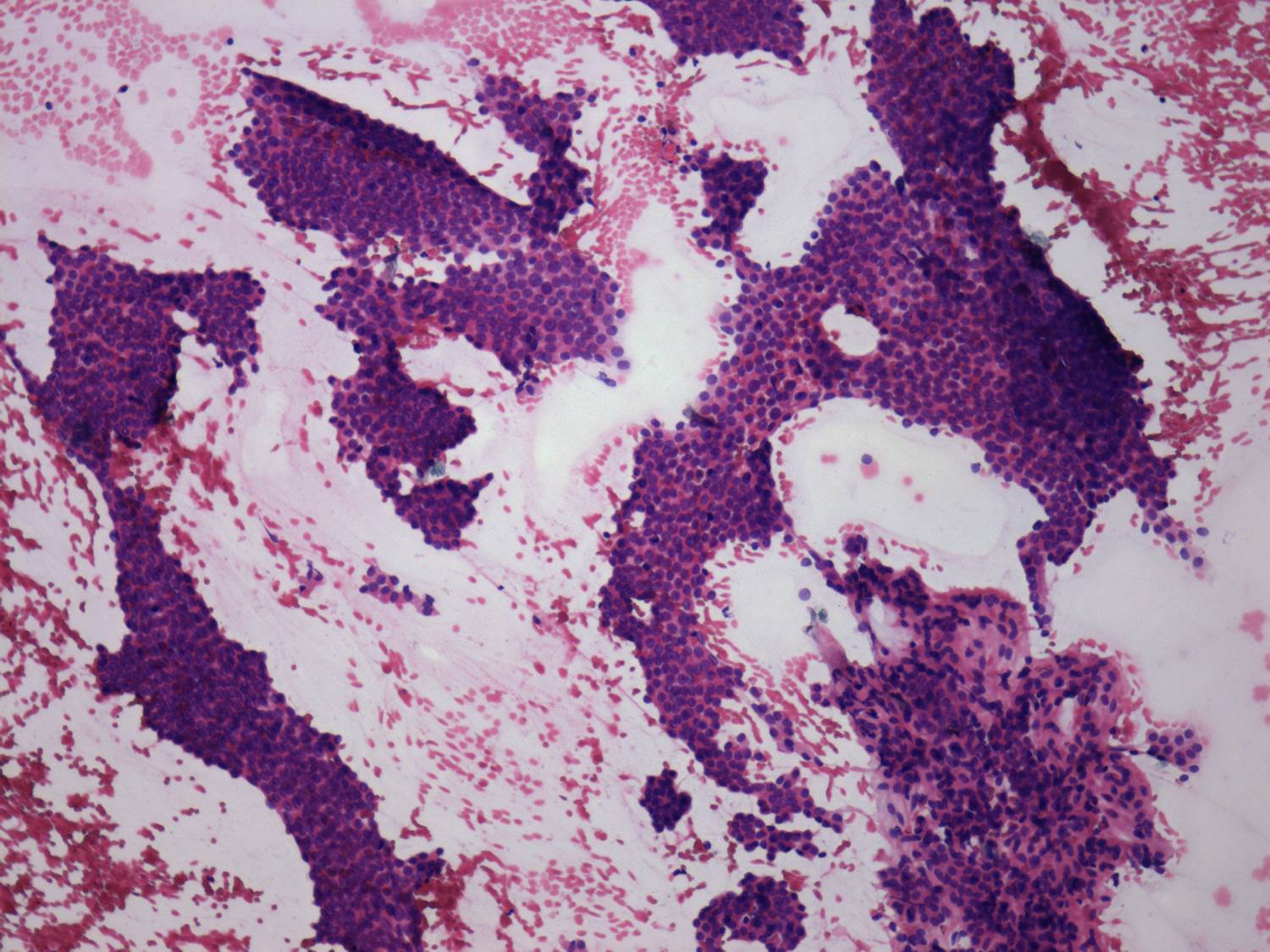 Right lobe, longitudinal scan