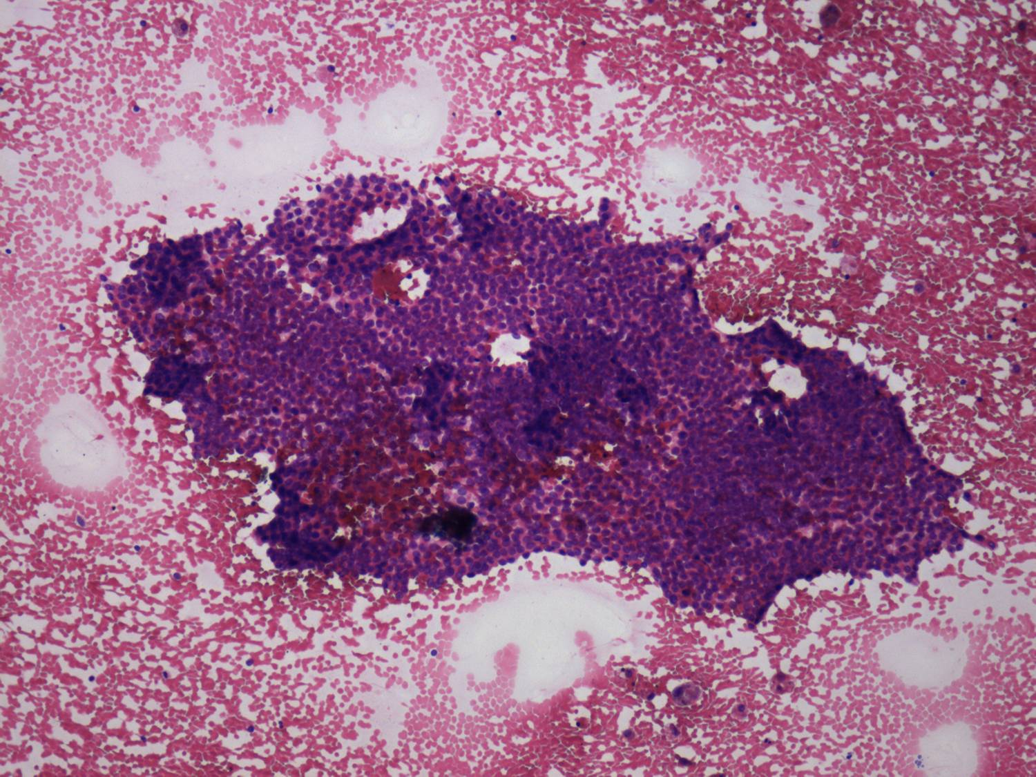 Right lobe, longitudinal scan
