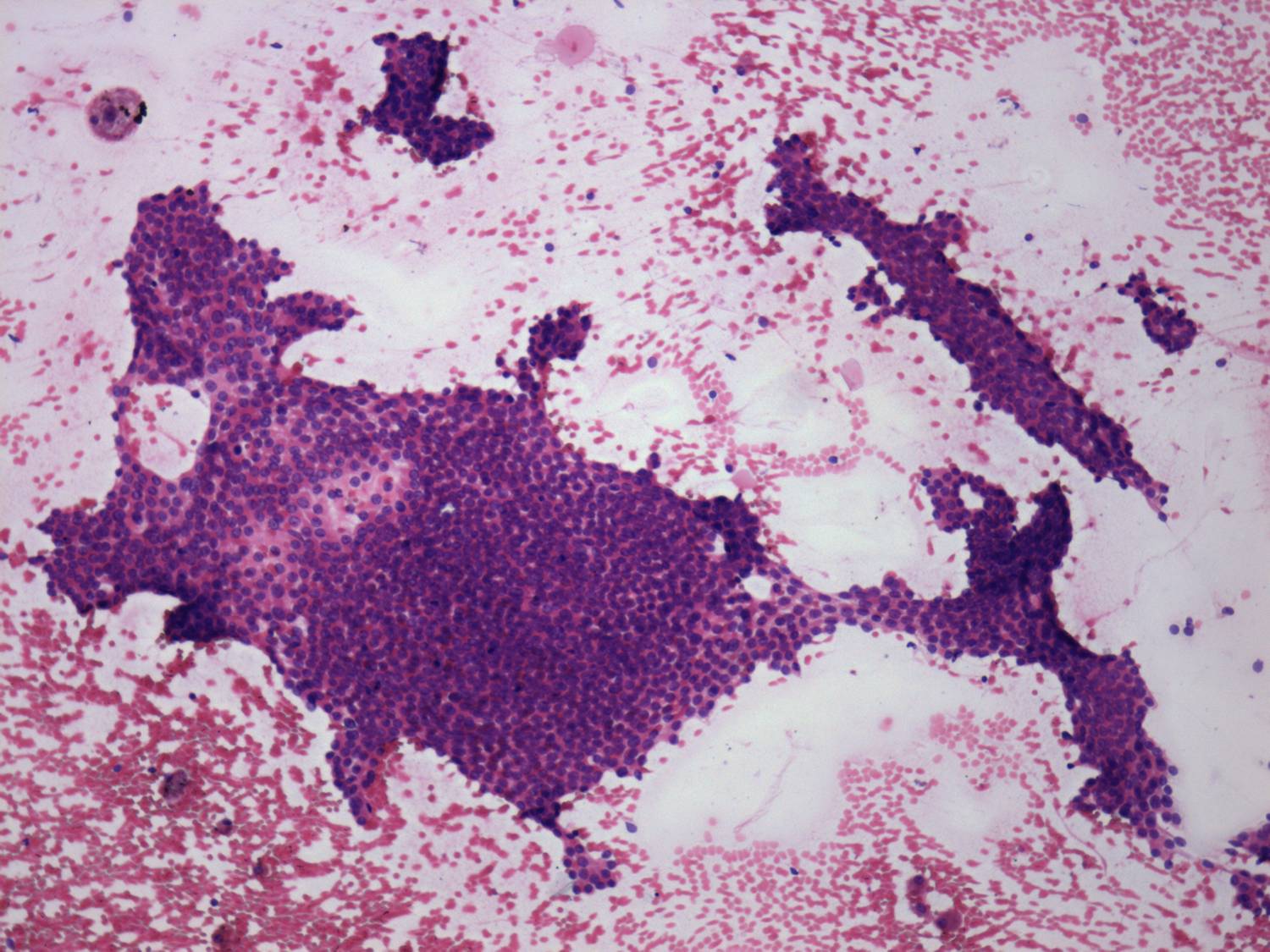 Right lobe, longitudinal scan