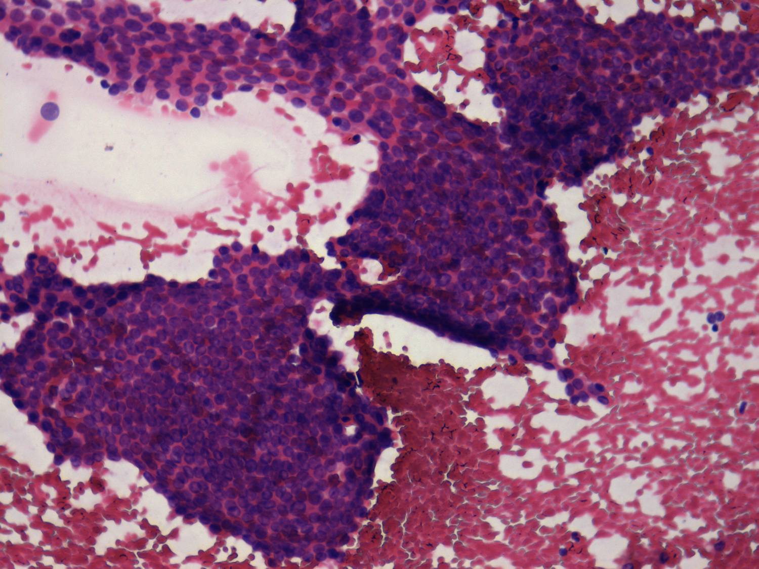 Right lobe, longitudinal scan
