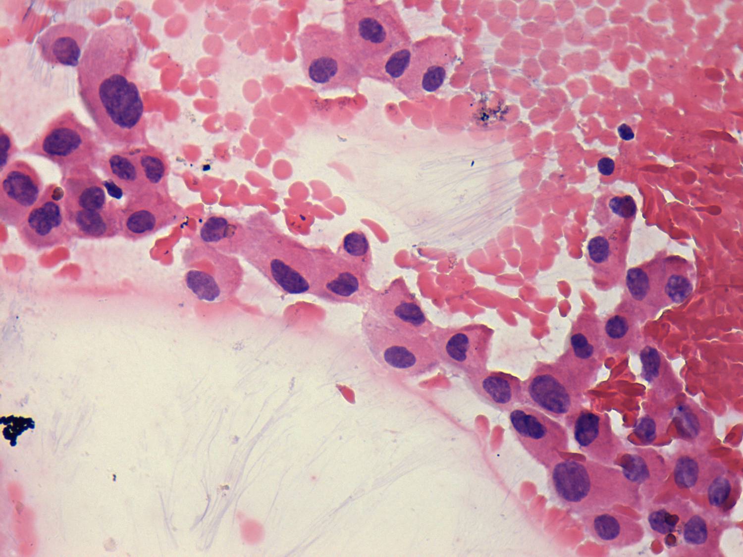 Right lobe, longitudinal scan