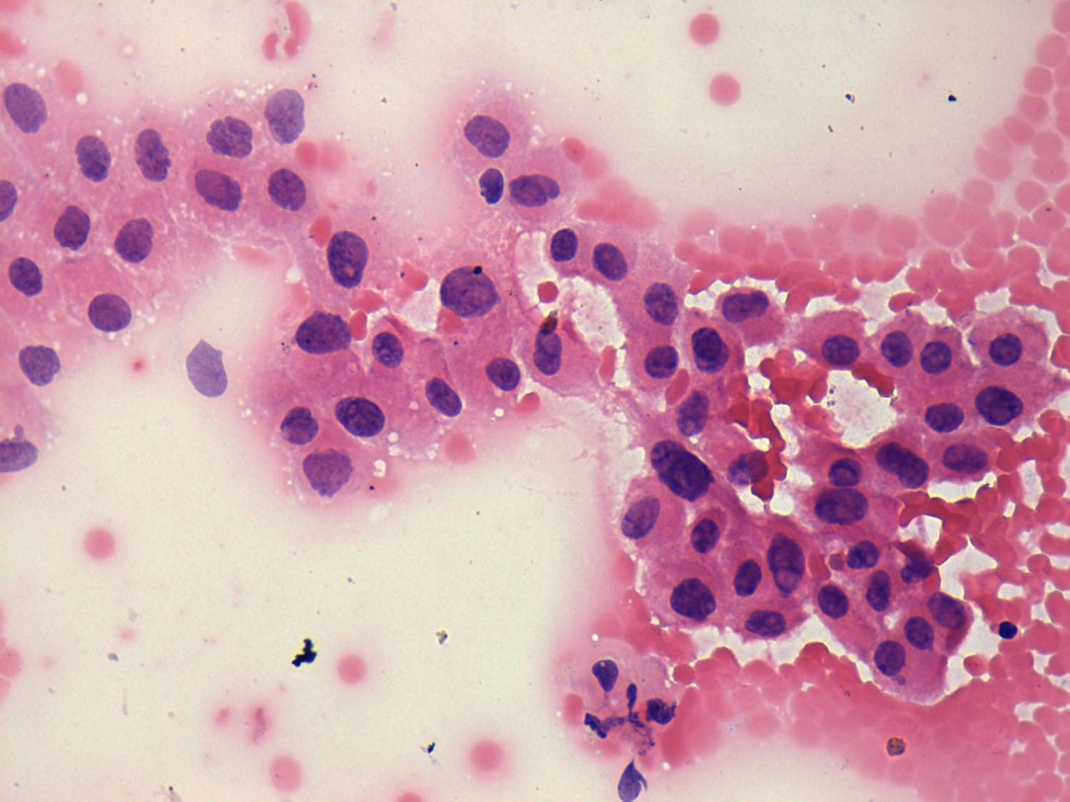 Right lobe, longitudinal scan