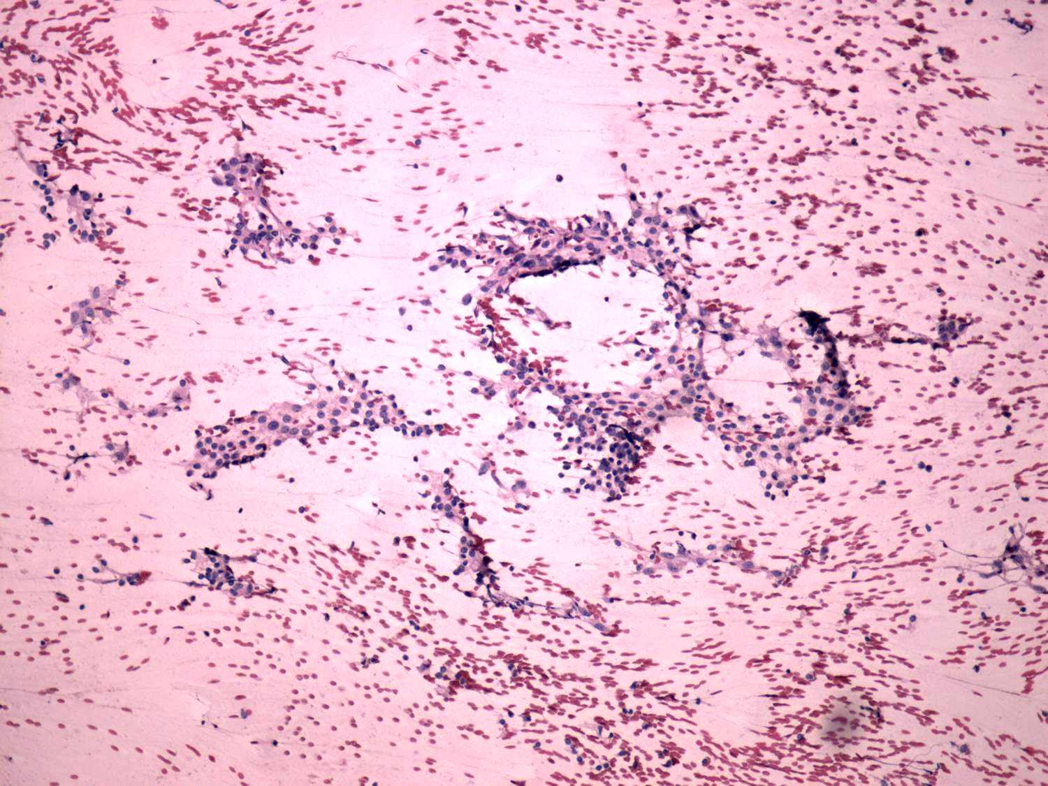 Right lobe, longitudinal scan