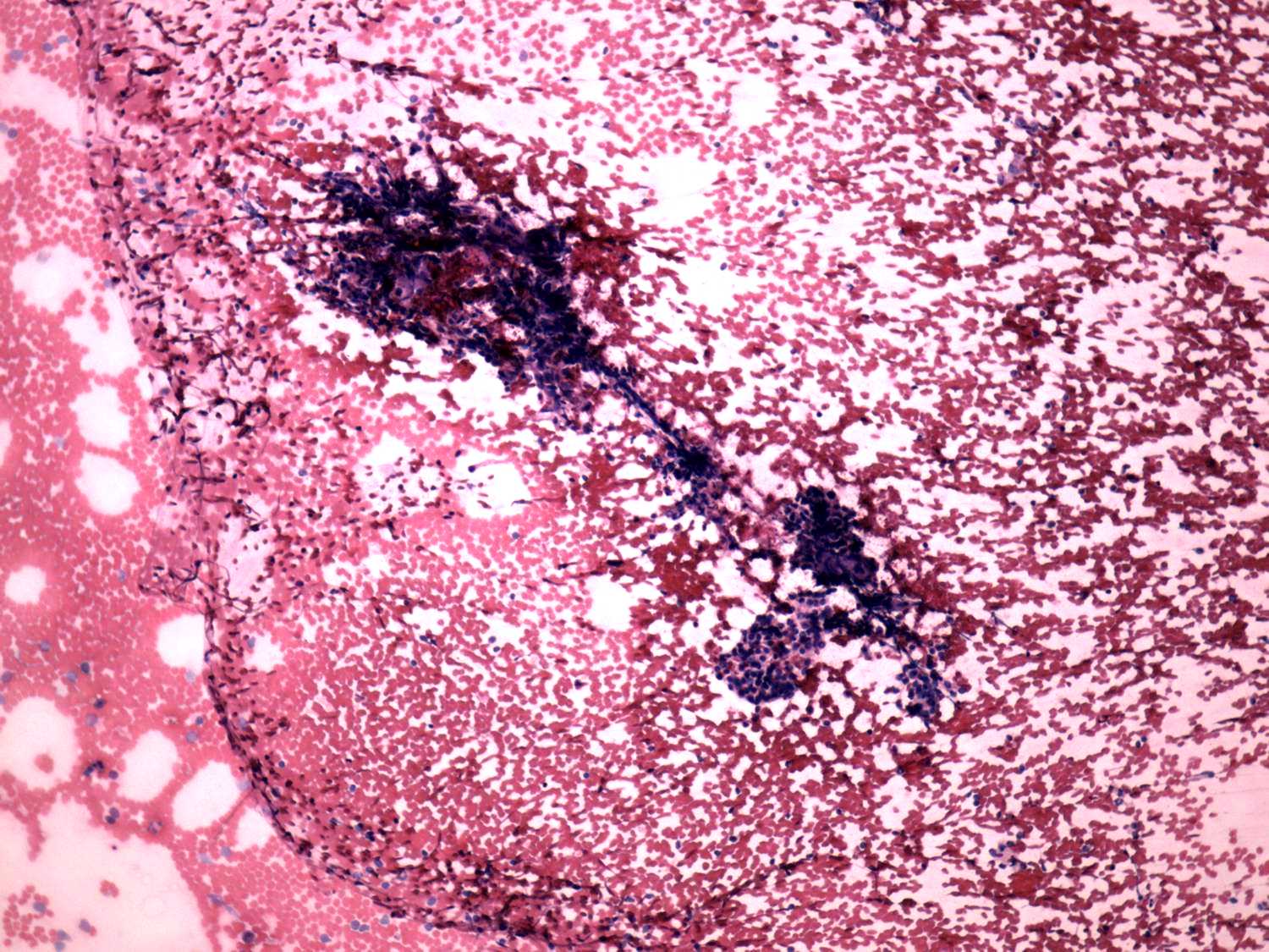 Right lobe, longitudinal scan