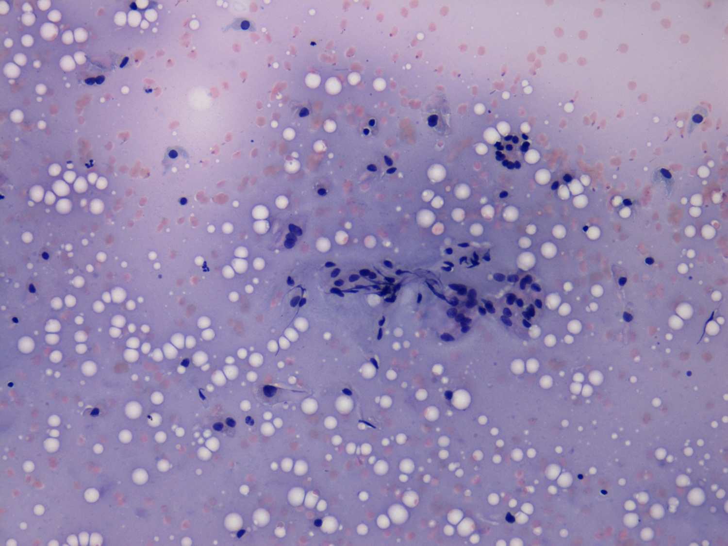 Right lobe, longitudinal scan