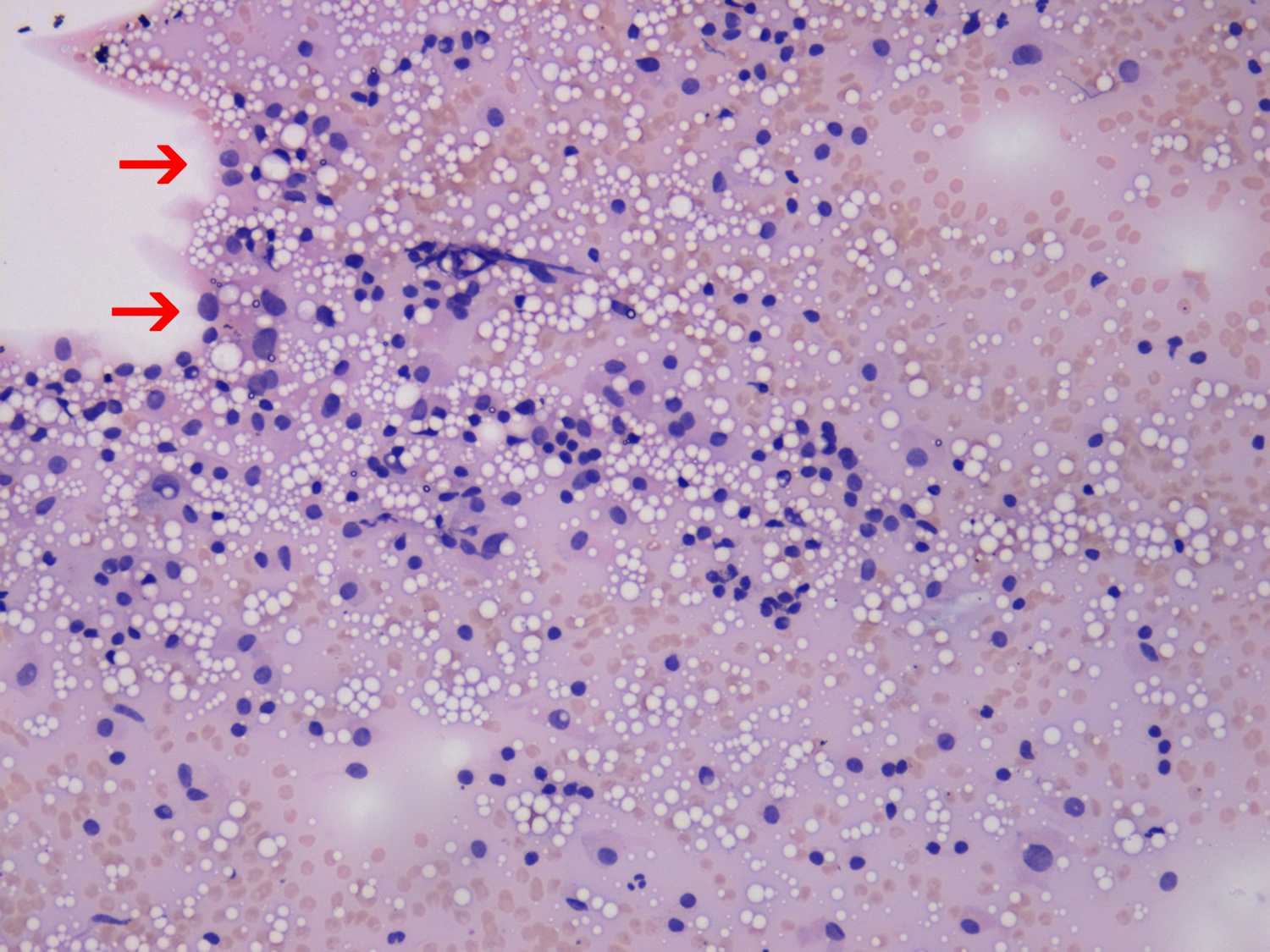 Right lobe, longitudinal scan