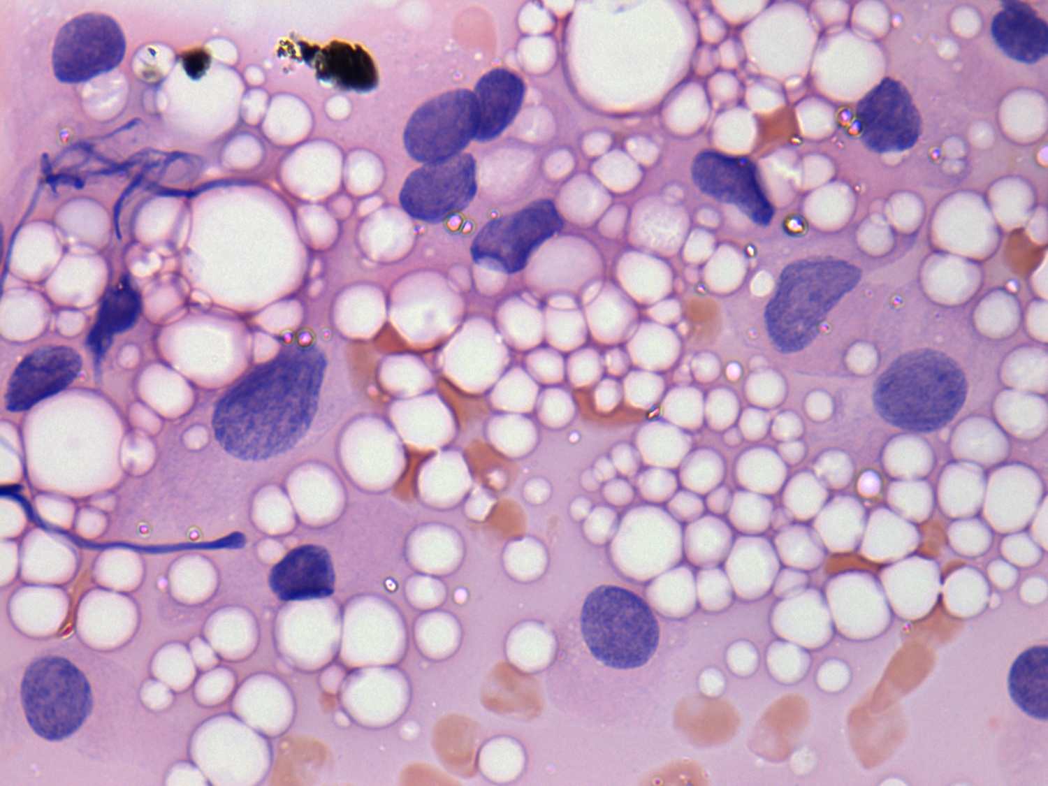 Right lobe, longitudinal scan