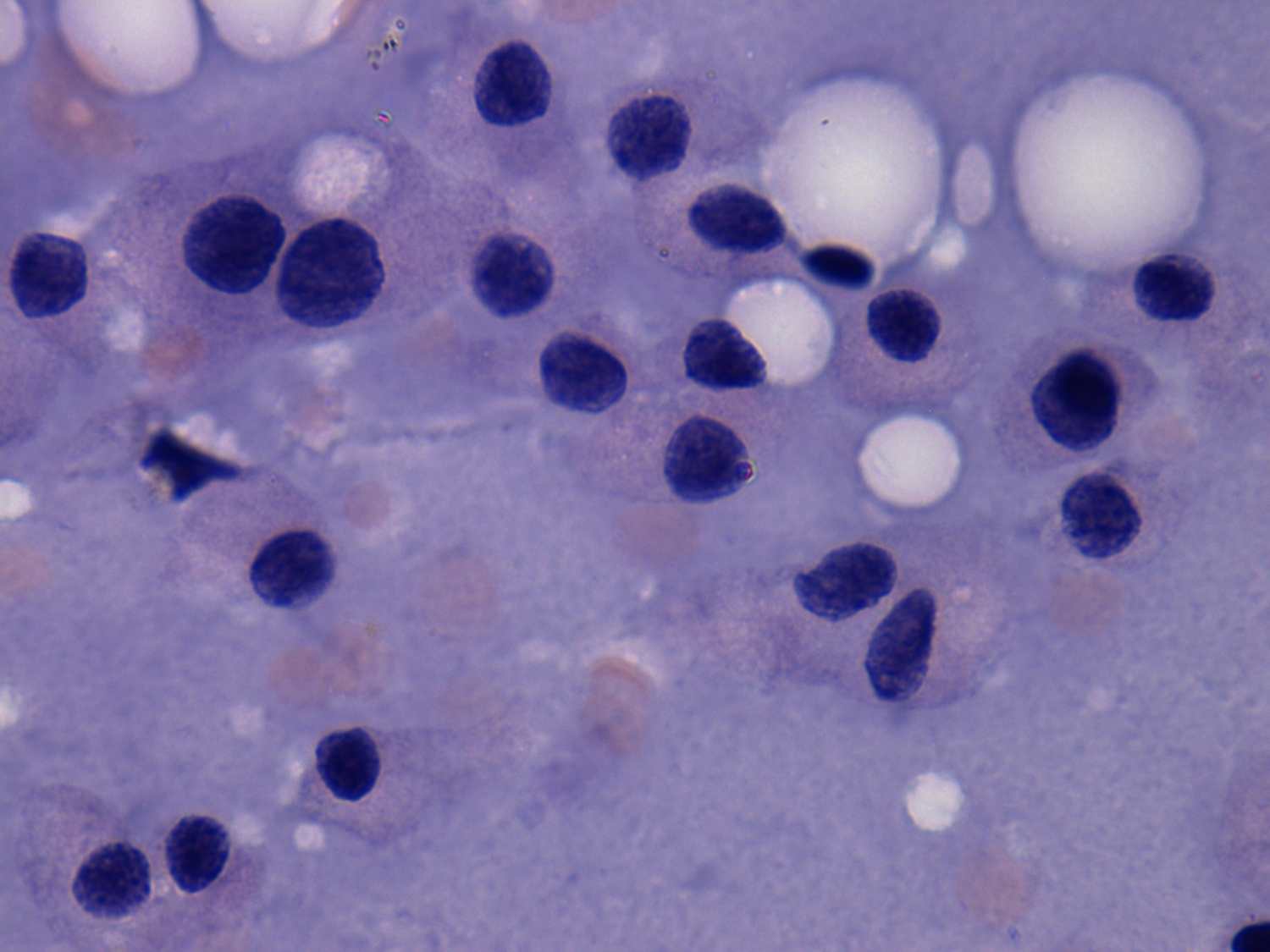 Right lobe, longitudinal scan
