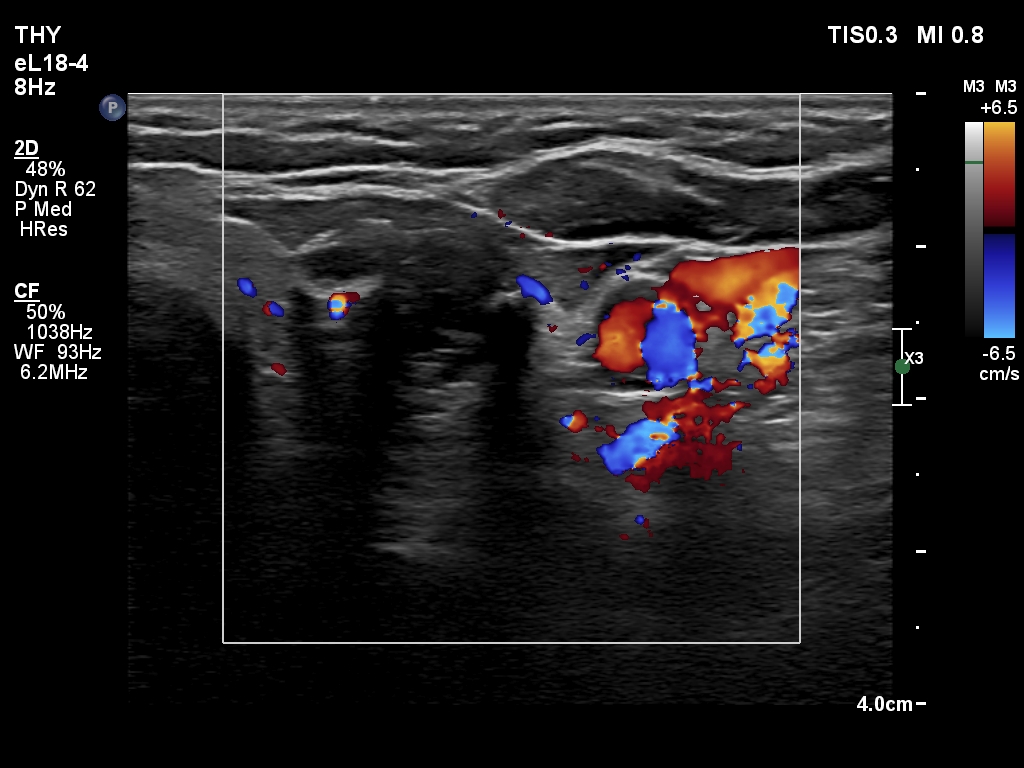 Right lobe, longitudinal scan