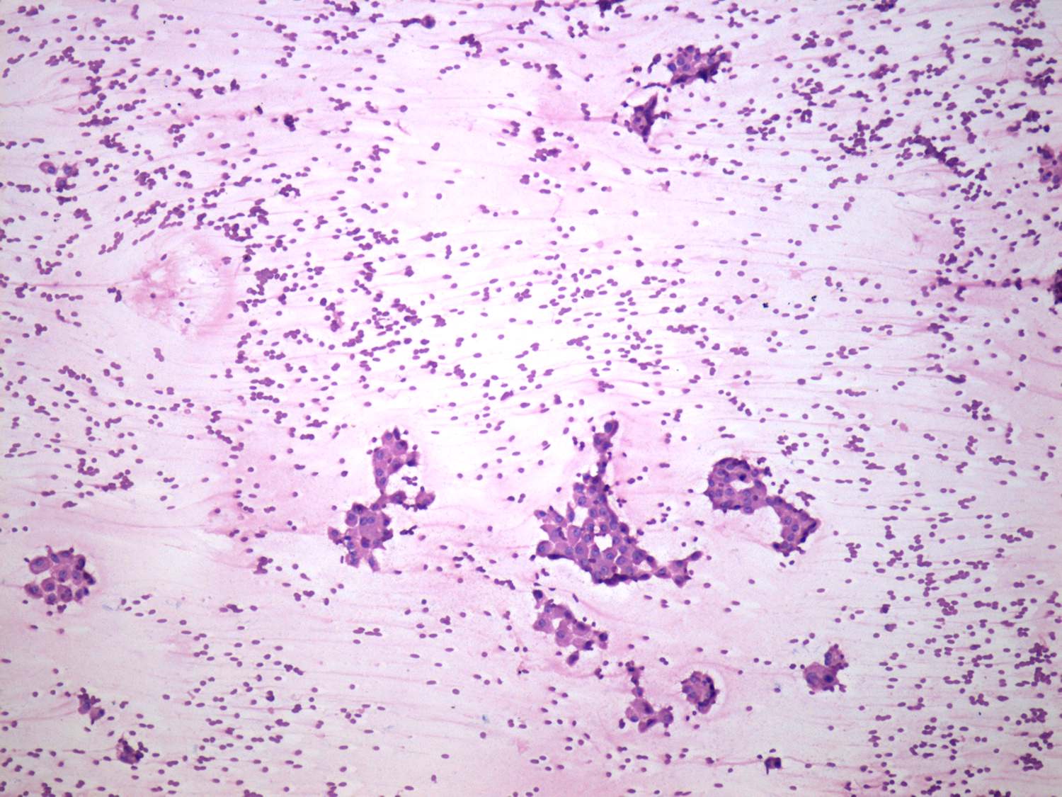Right lobe, longitudinal scan