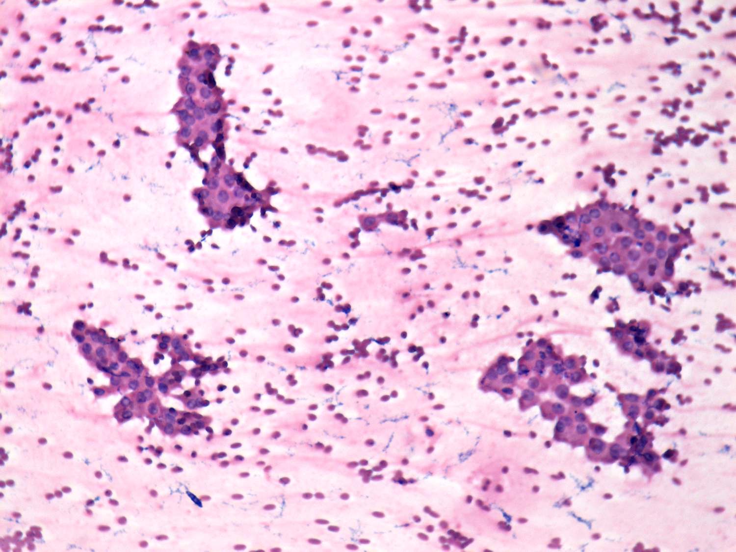Right lobe, longitudinal scan