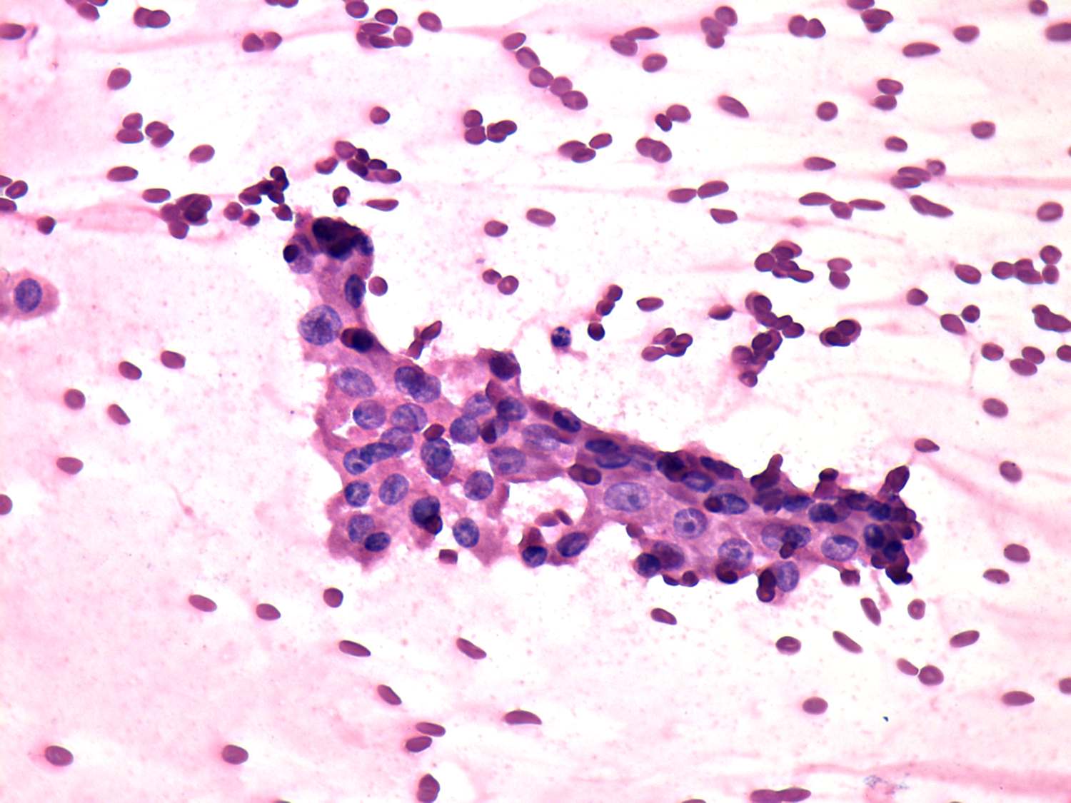 Right lobe, longitudinal scan