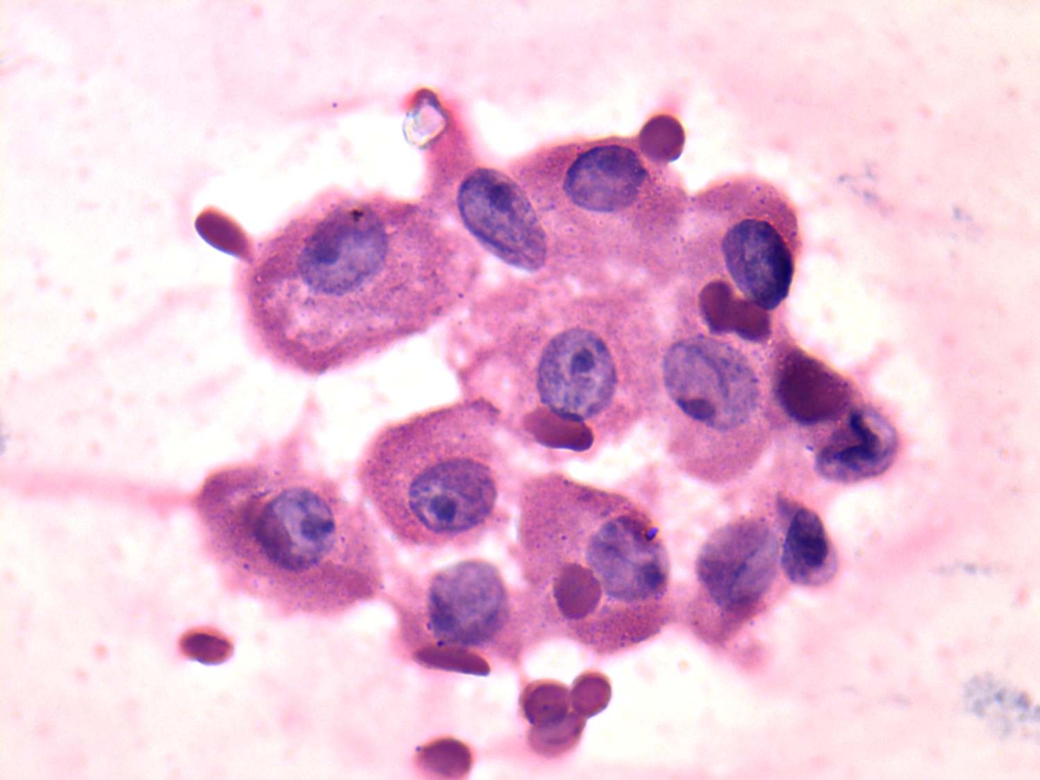 Right lobe, longitudinal scan