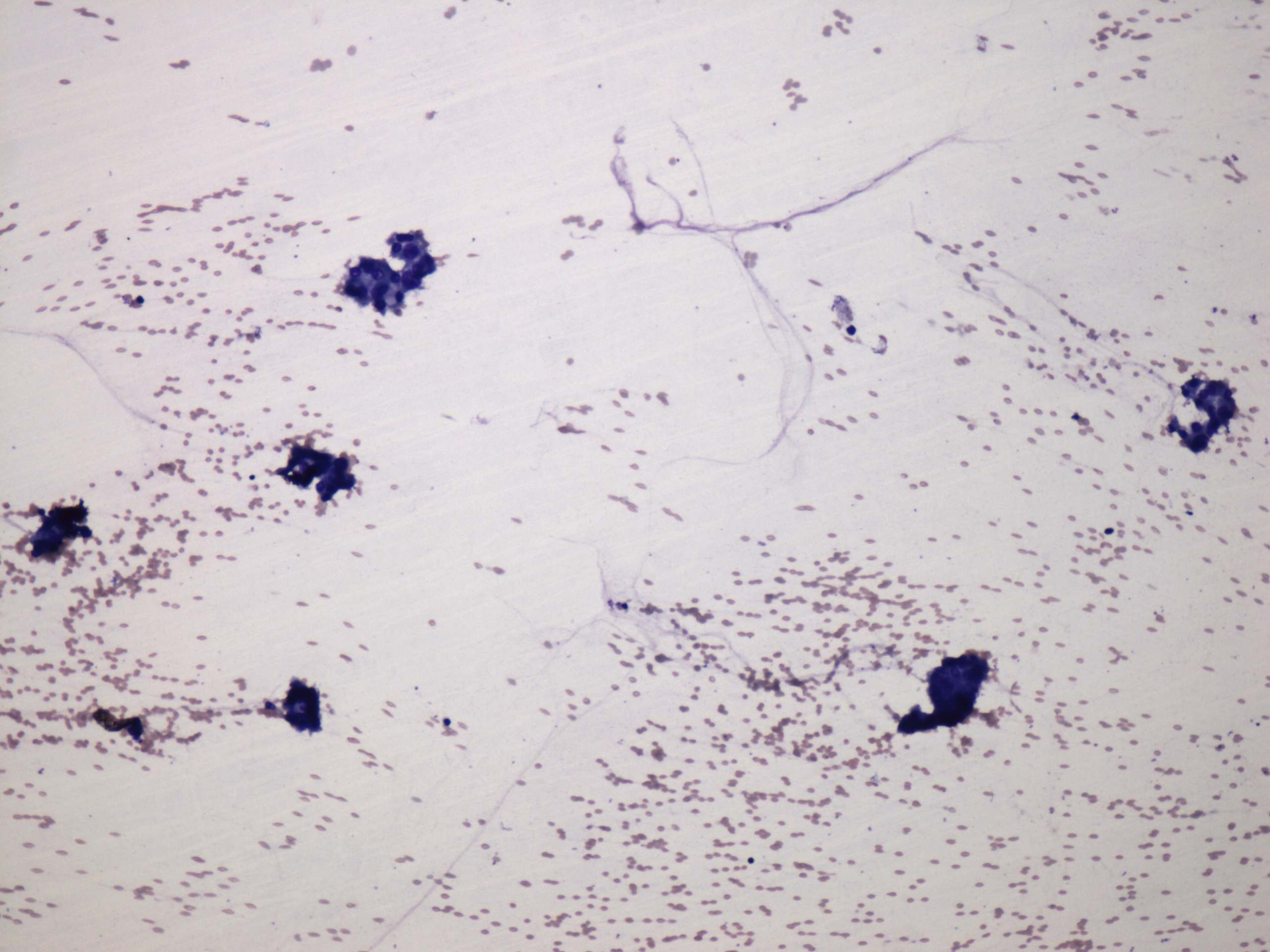 Right lobe, longitudinal scan