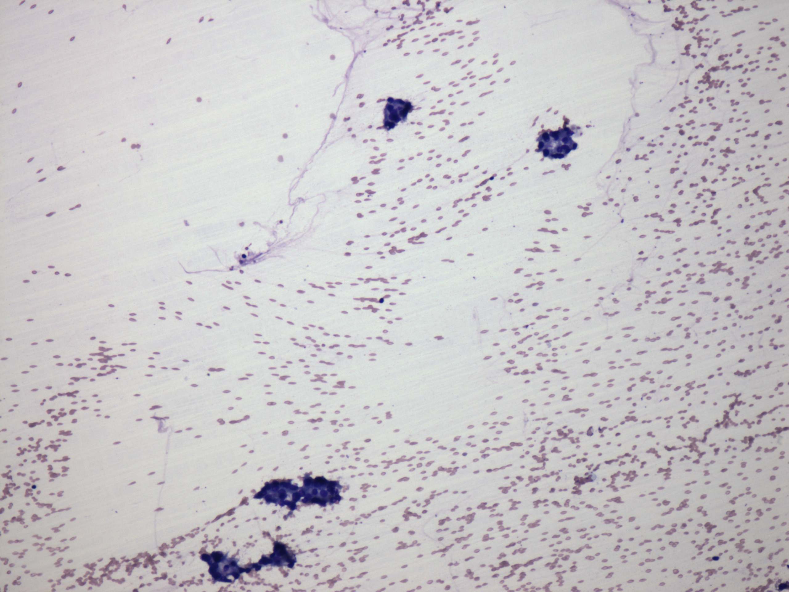 Right lobe, longitudinal scan