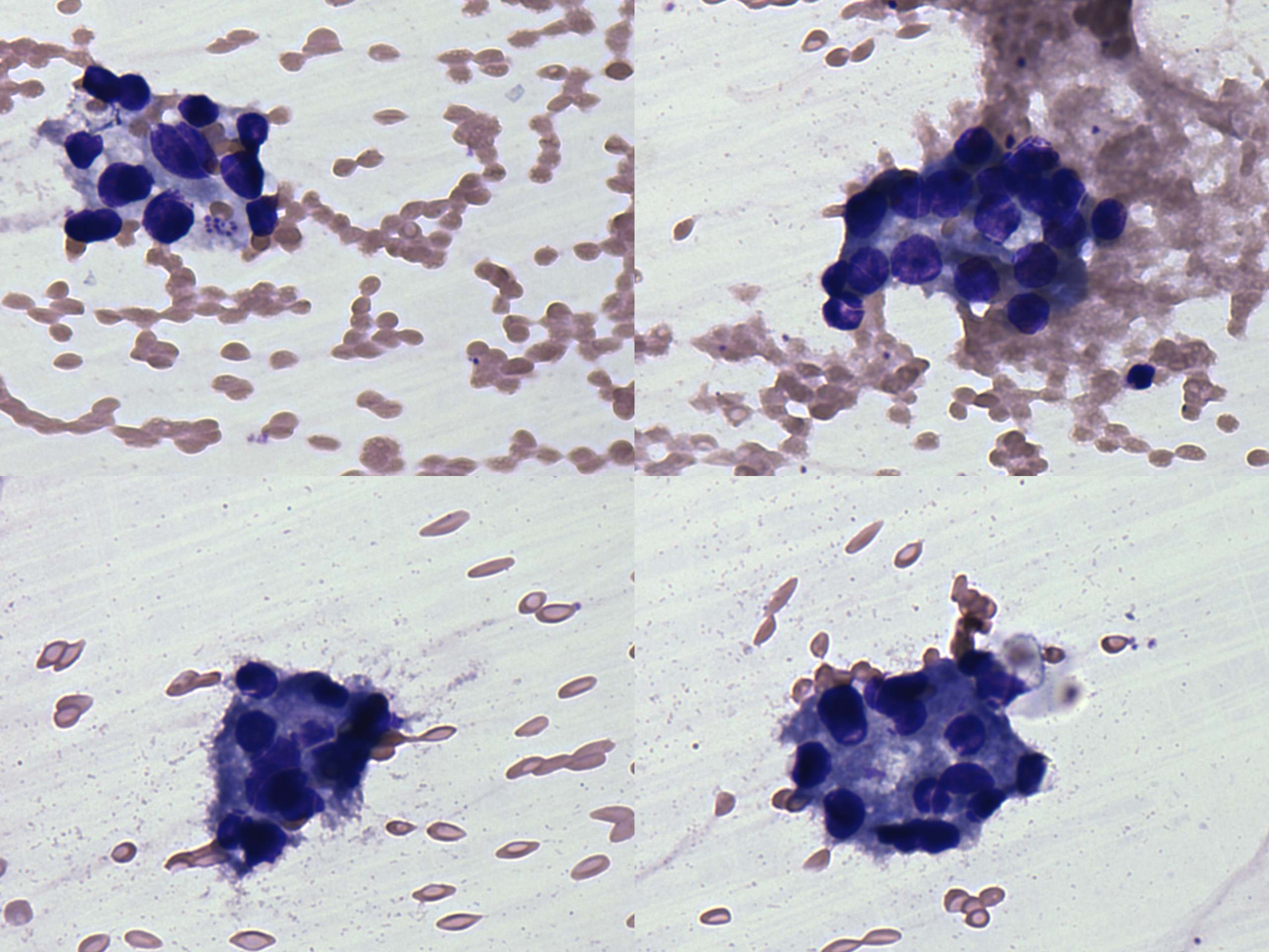 Right lobe, longitudinal scan