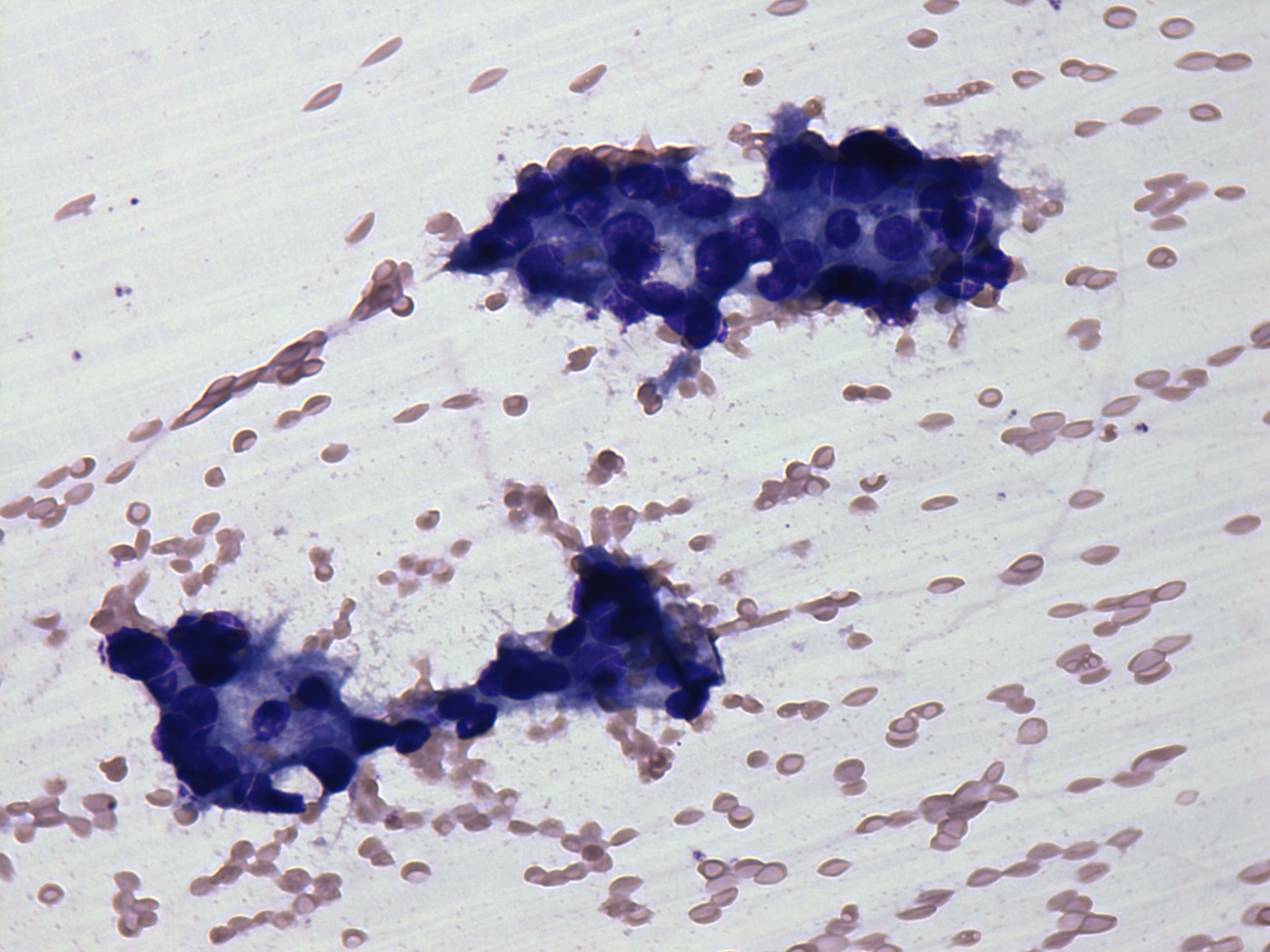 Right lobe, longitudinal scan